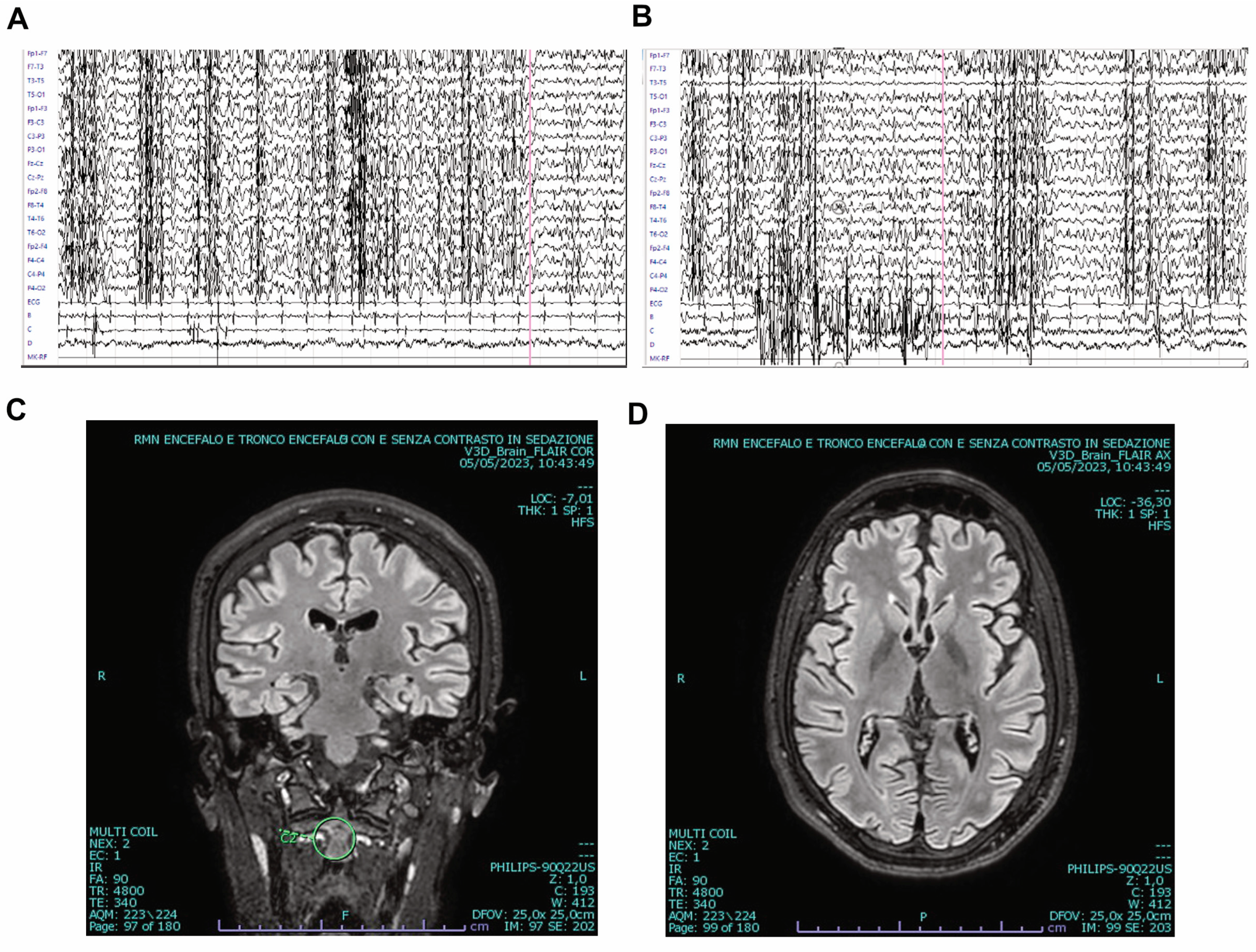Brainsci 13 01679 g001