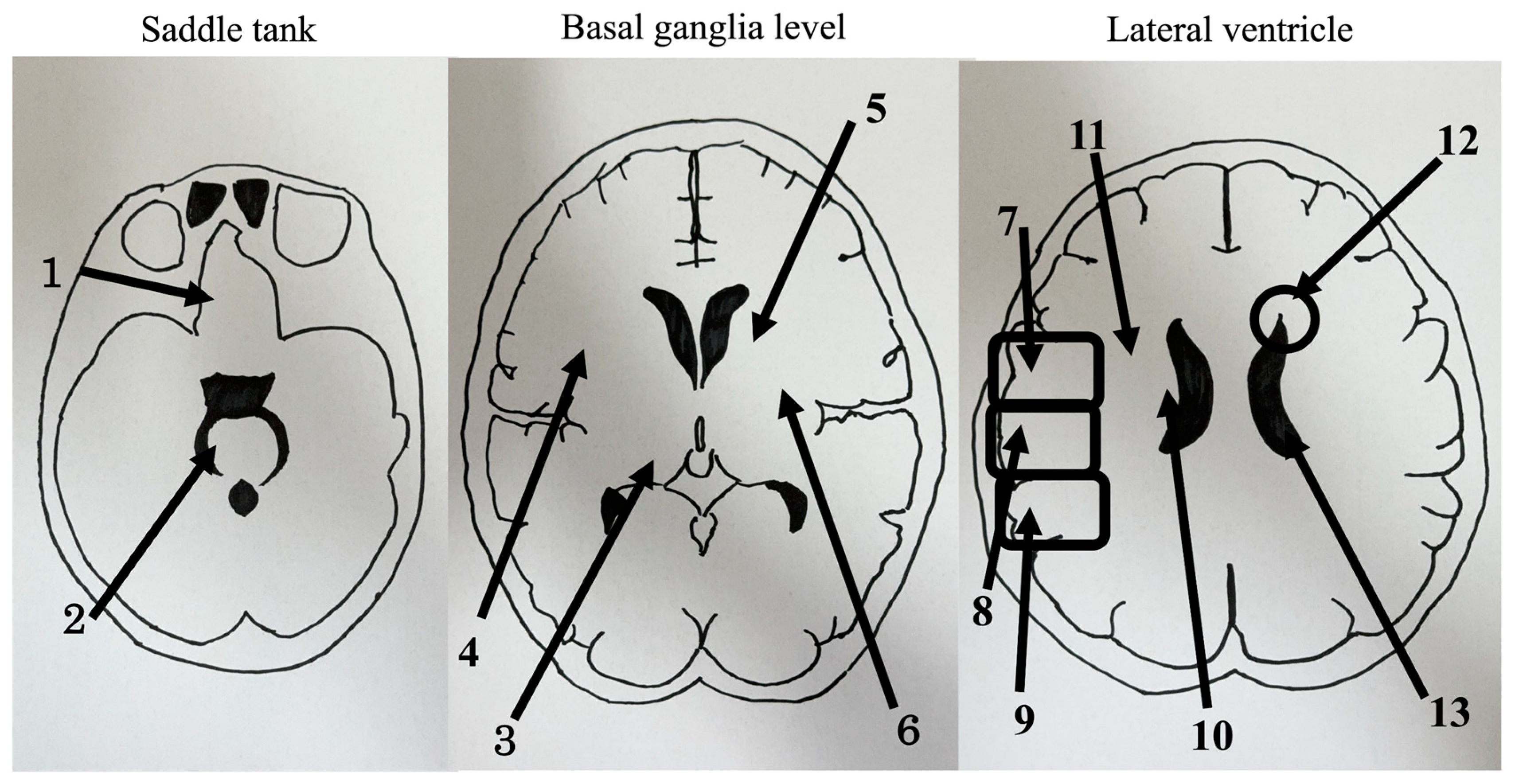 Brainsci 13 01690 g001