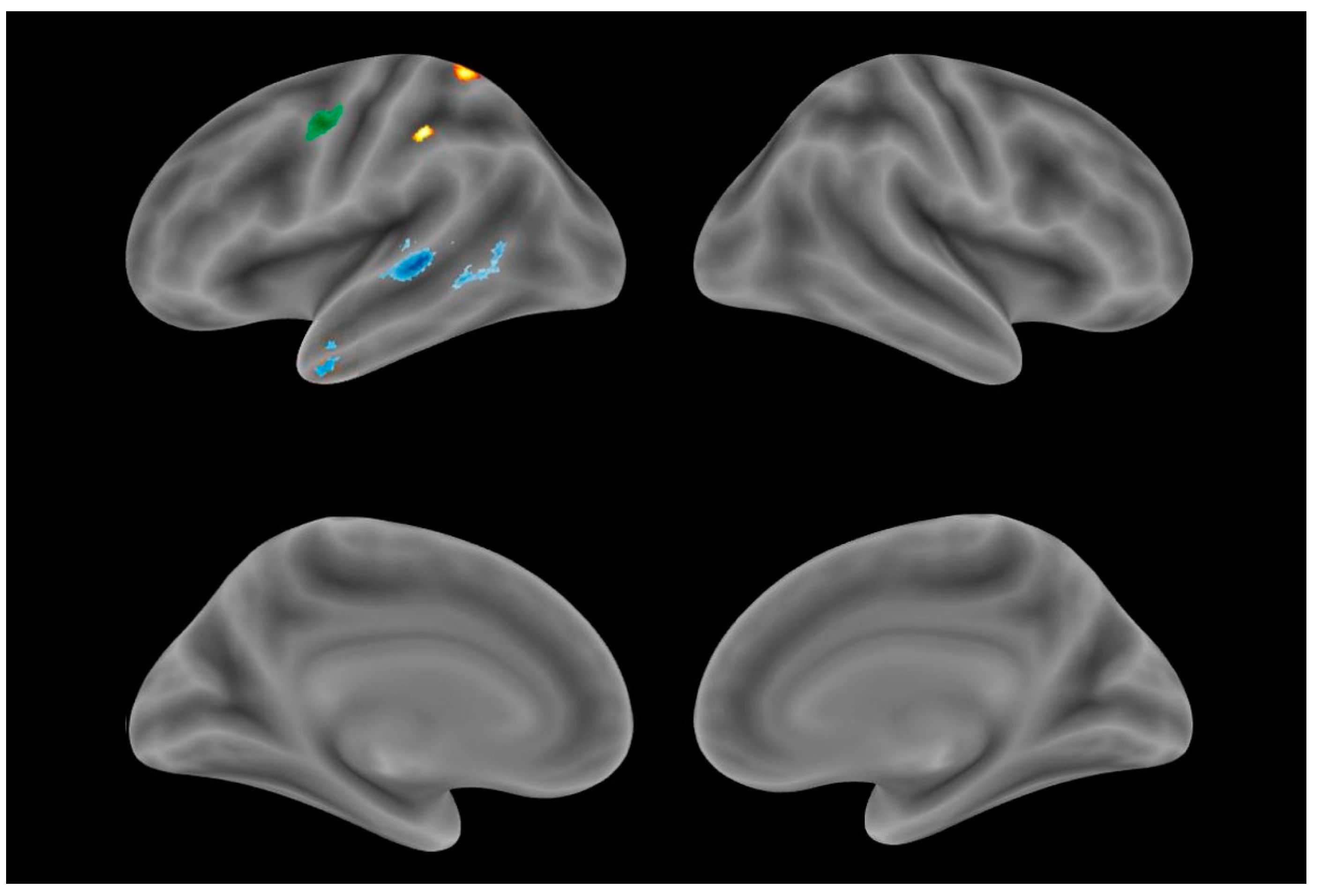 Brainsci 13 01703 g001 Brainsci 13 01703 g001
