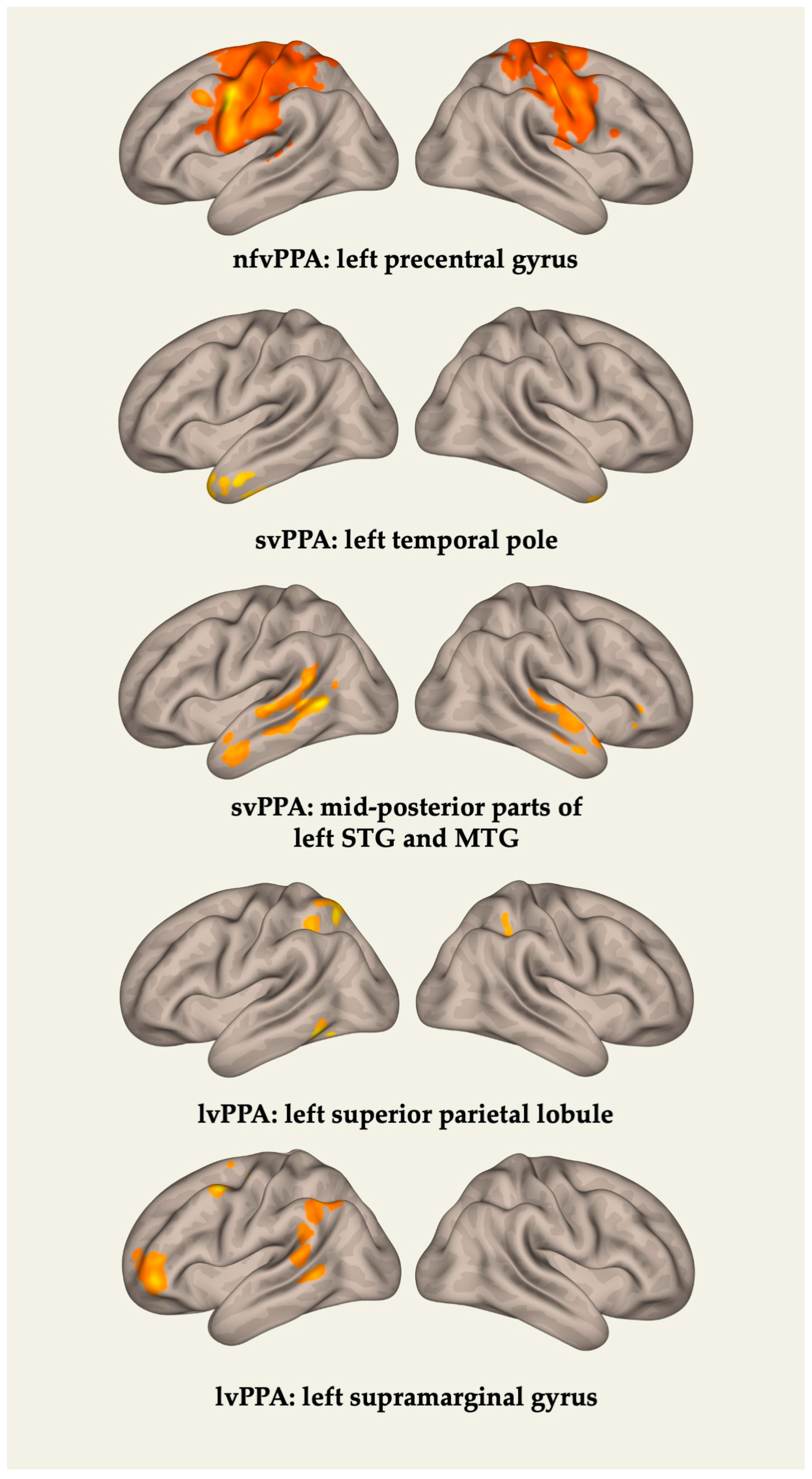 Brainsci 13 01703 g003 Brainsci 13 01703 g003