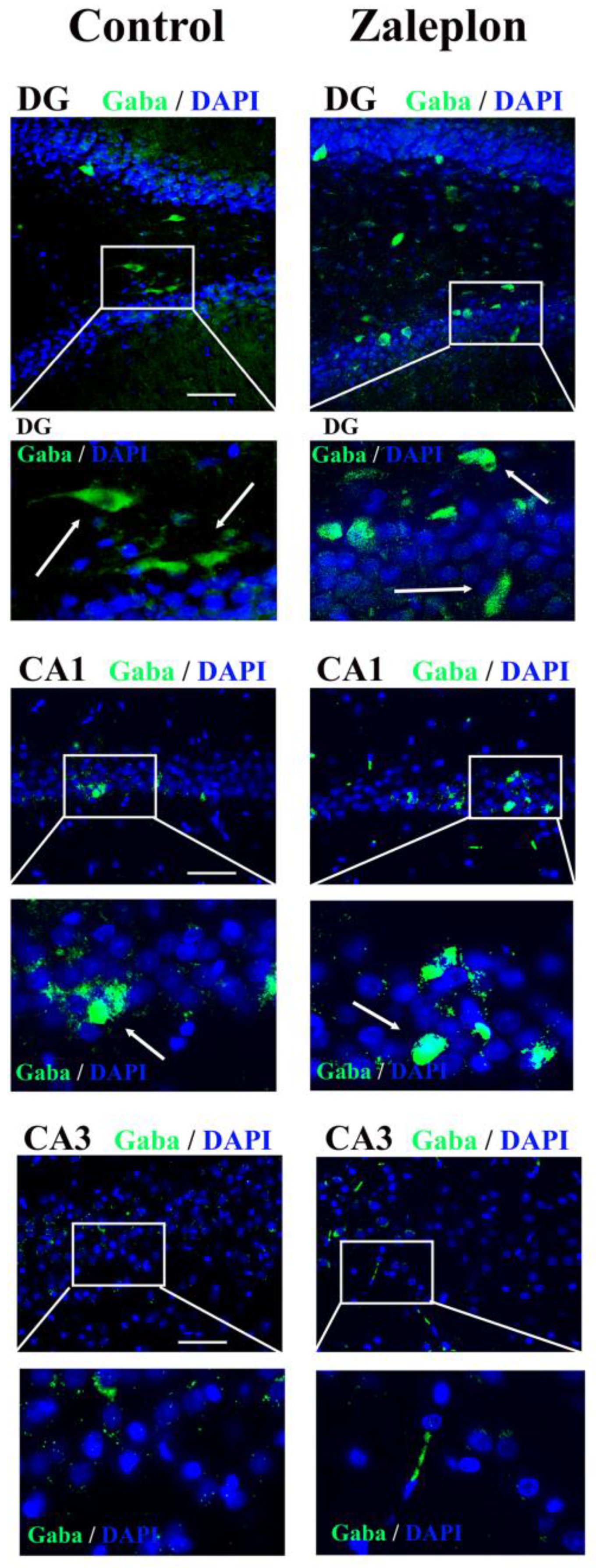 Brainsci 13 01707 g003 Brainsci 13 01707 g003