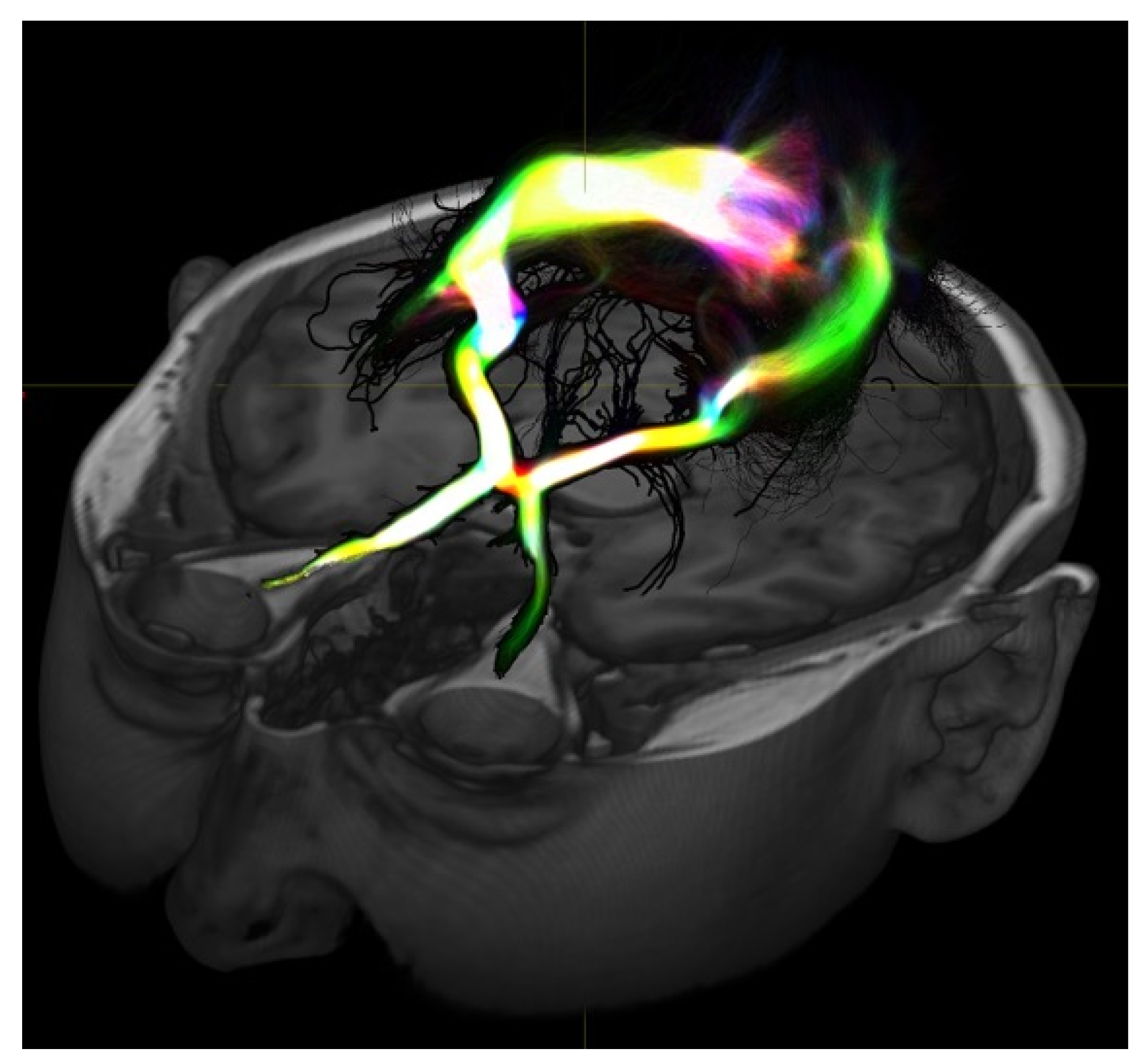 Brainsci 14 00031 g001