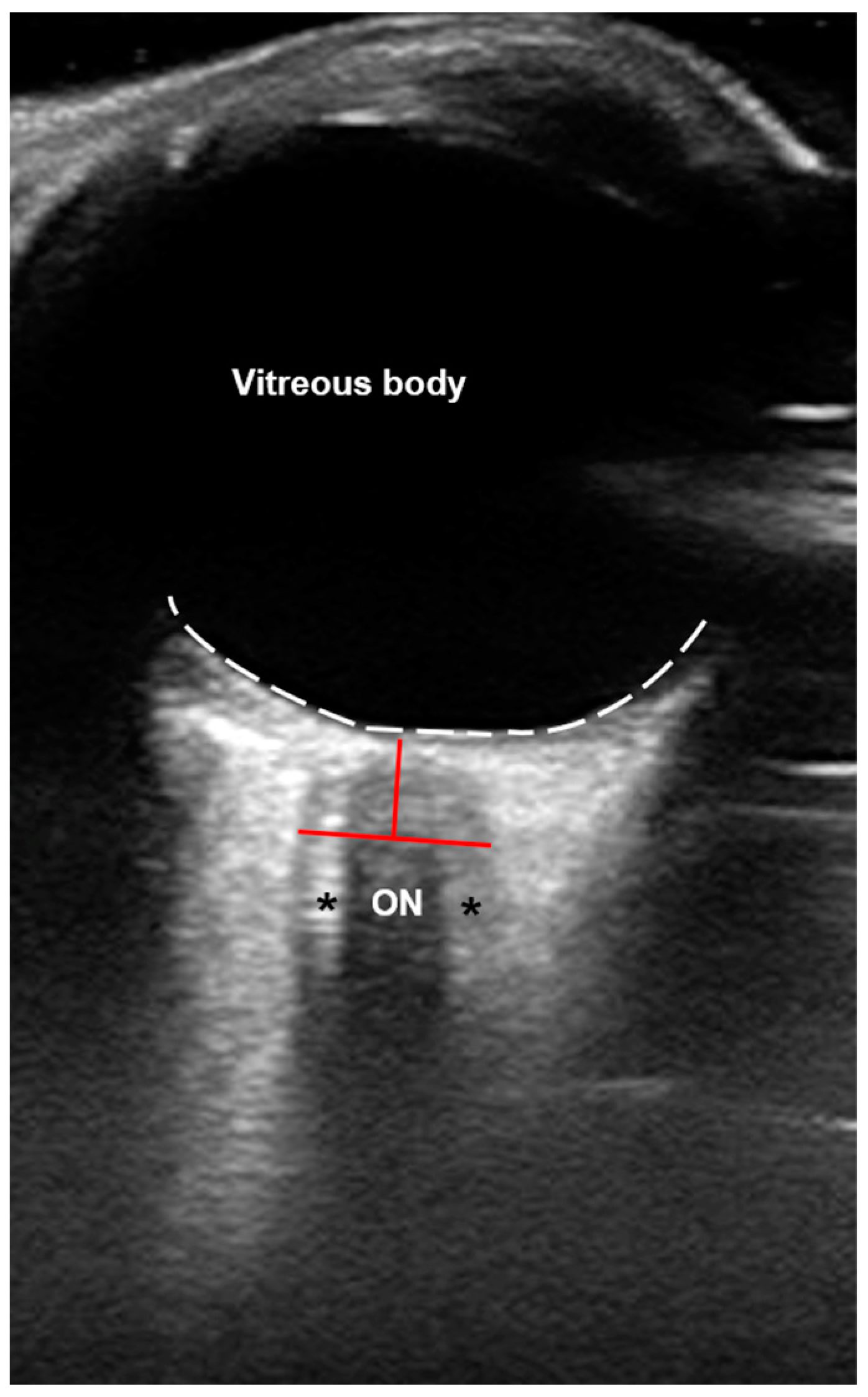 Brainsci 14 00032 g001