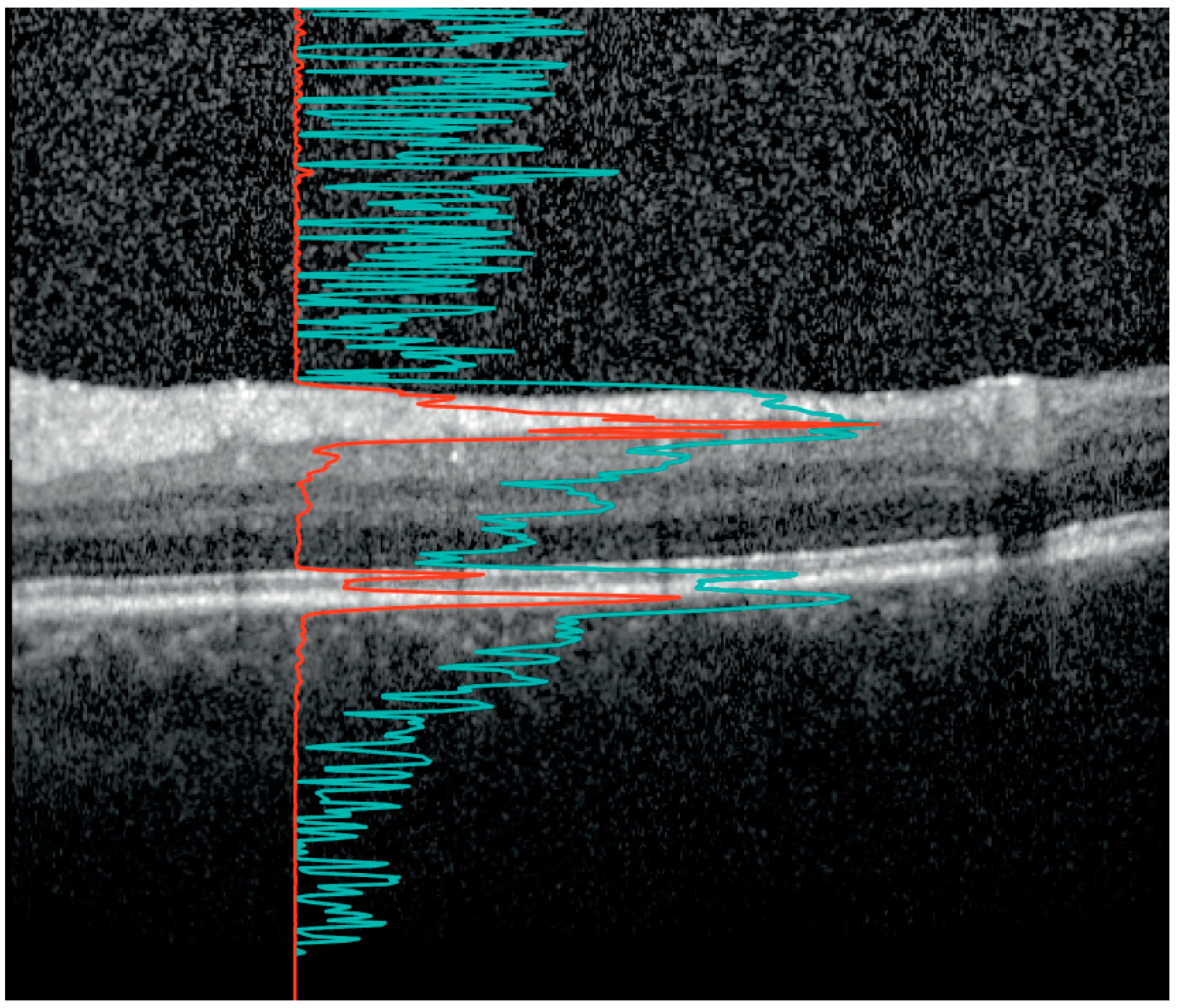 Brainsci 14 00036 g001