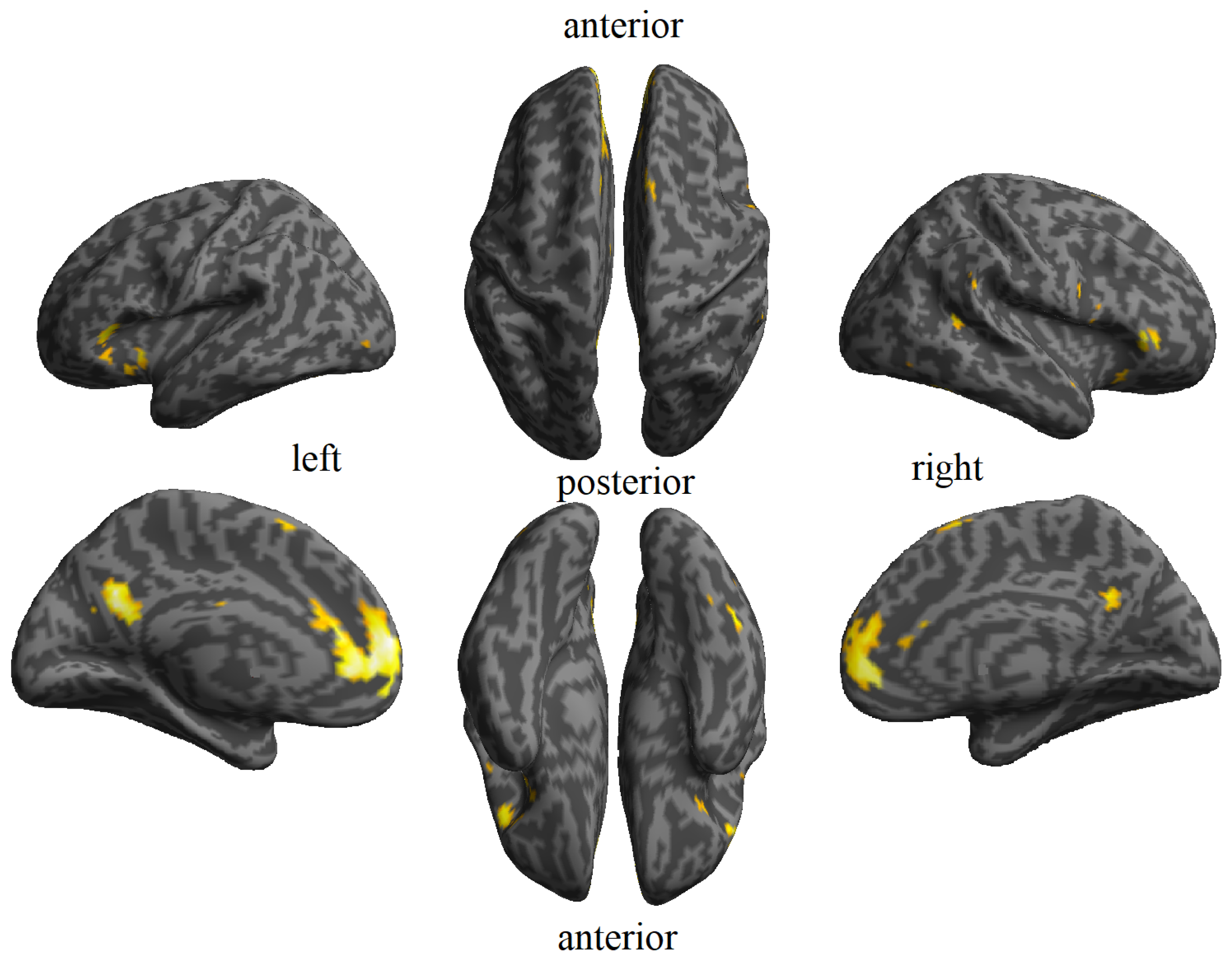 Brainsci 14 00039 g003