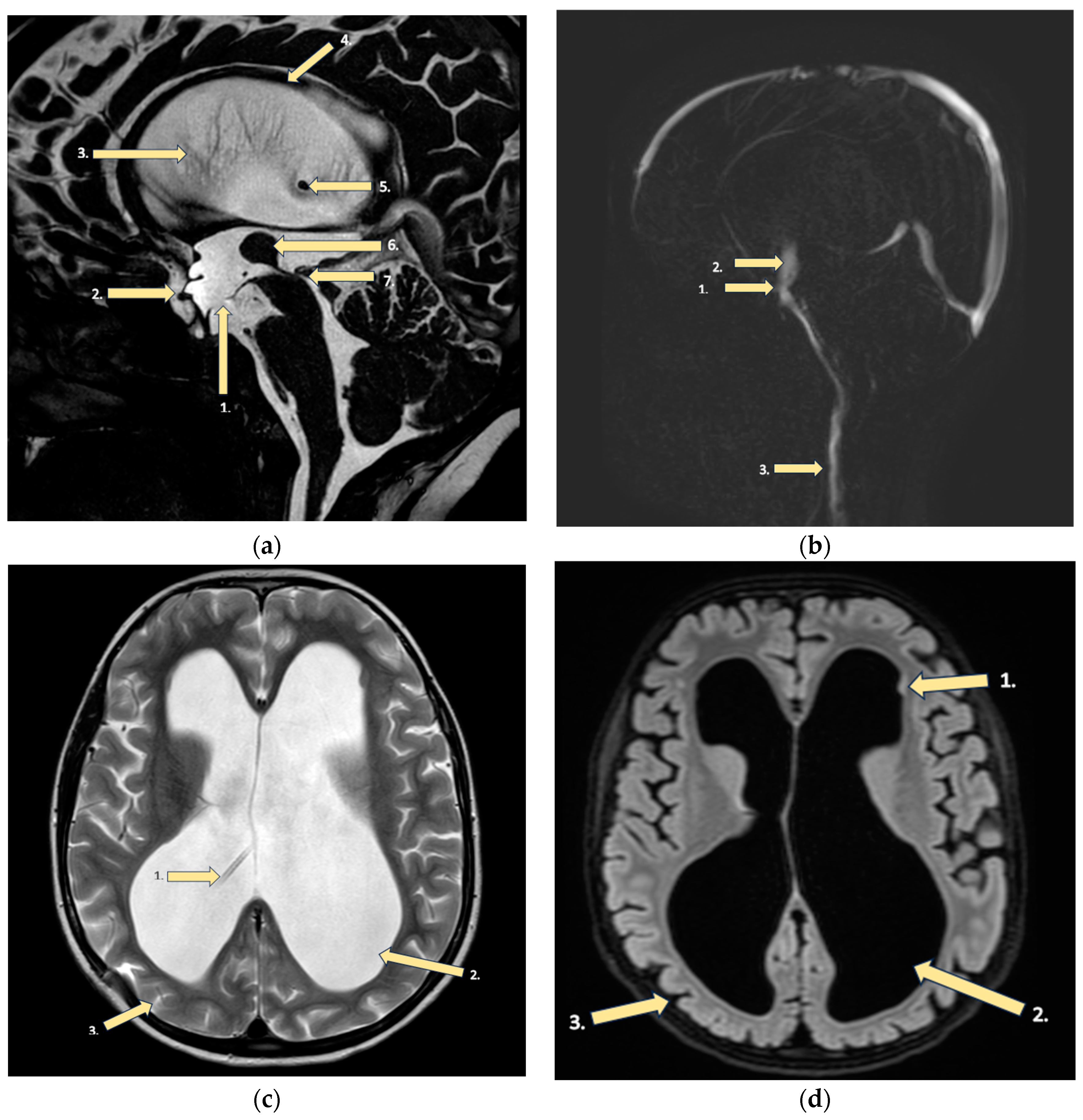 Brainsci 14 00079 g002 Brainsci 14 00079 g002