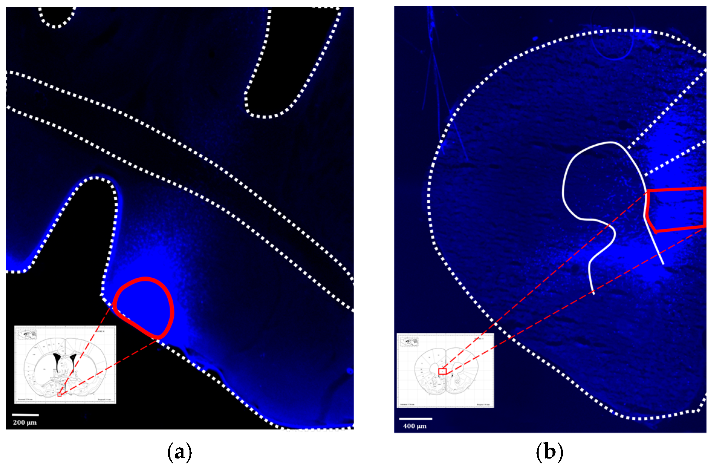 Brainsci 14 00105 g010
