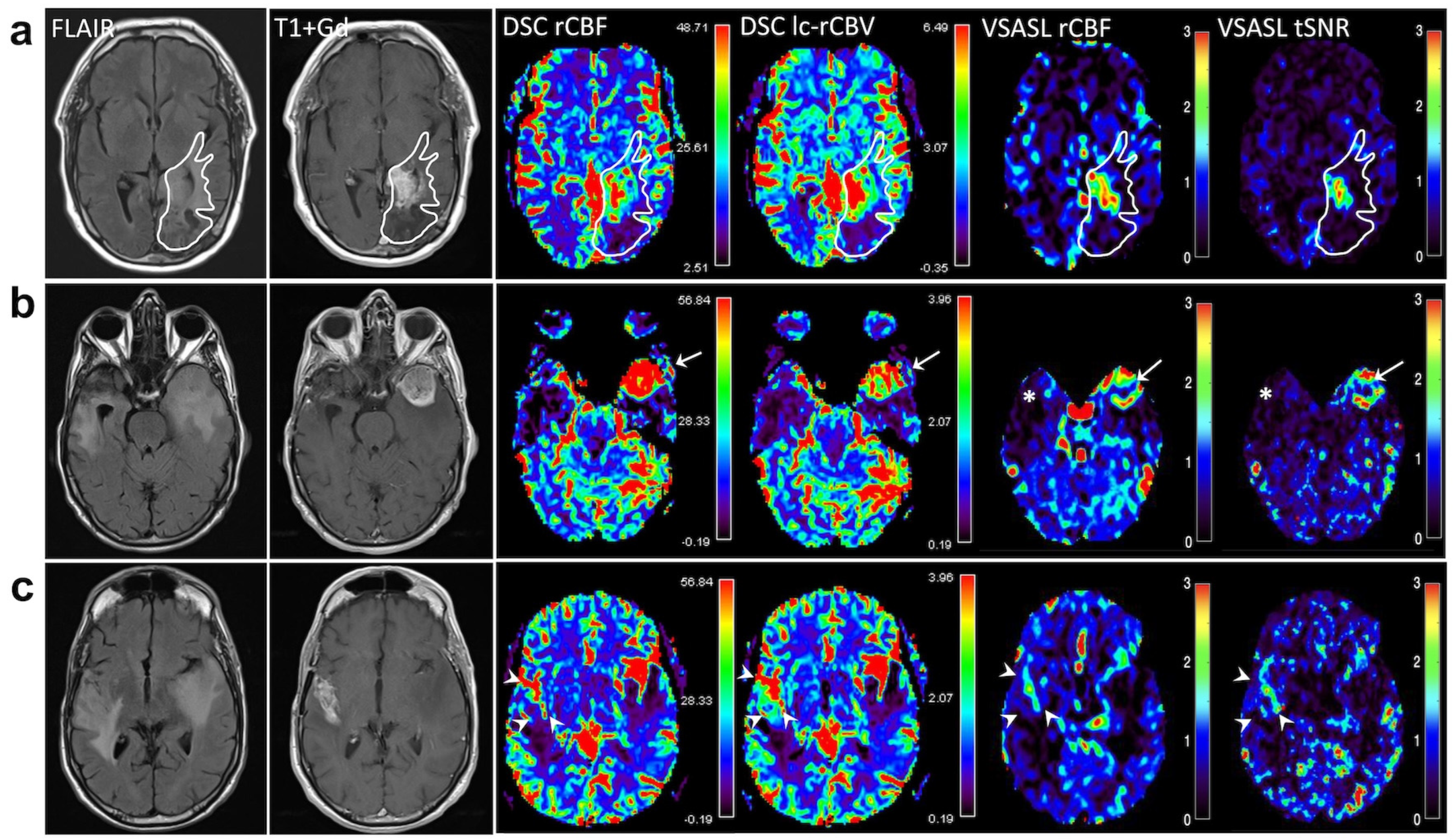 Brainsci 14 00126 g001