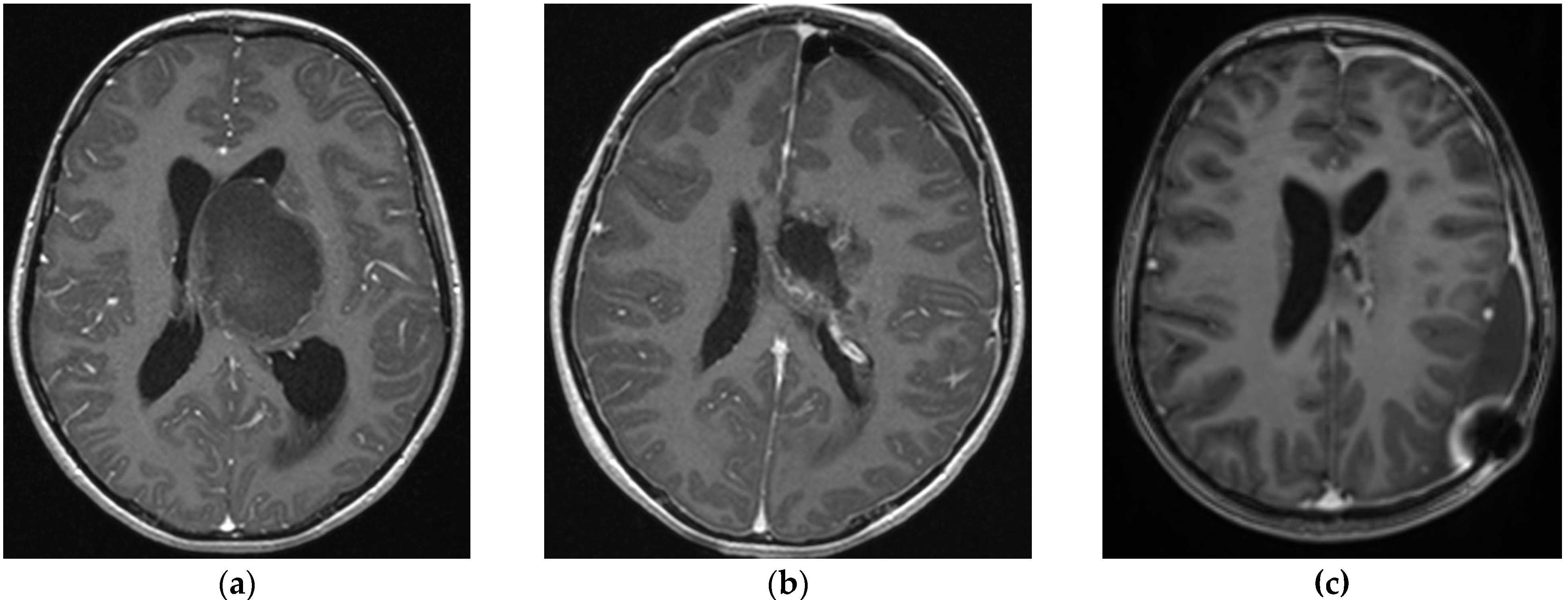 Brainsci 14 00141 g001 Brainsci 14 00141 g001