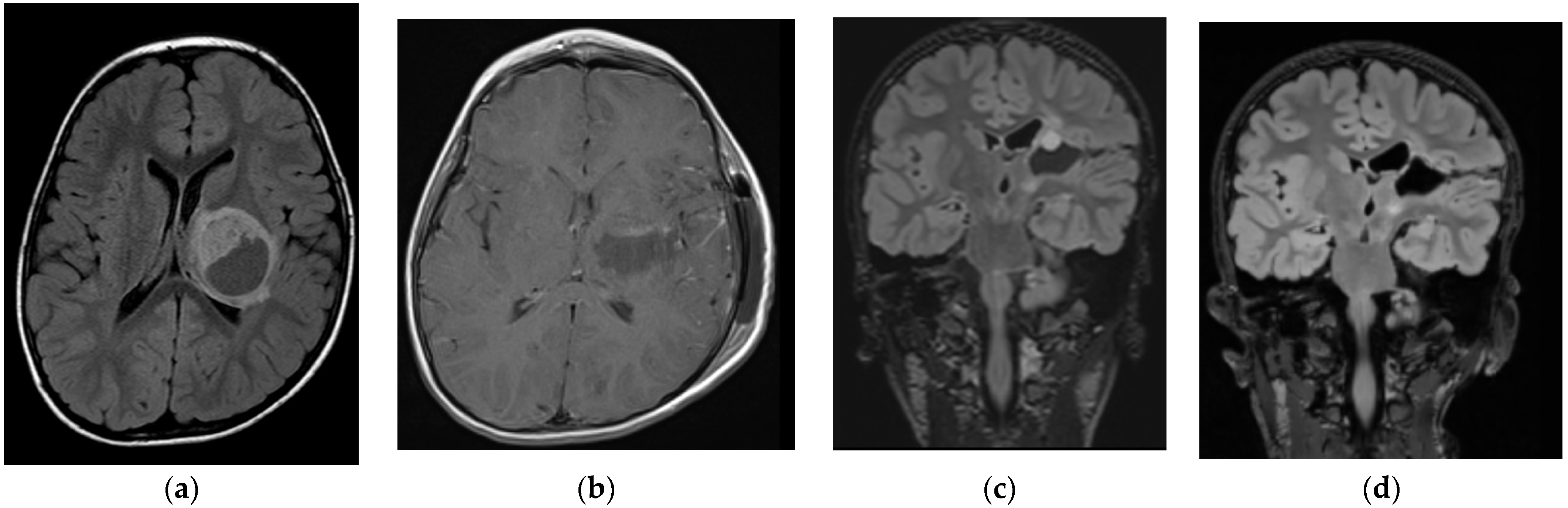 Brainsci 14 00141 g002 Brainsci 14 00141 g002