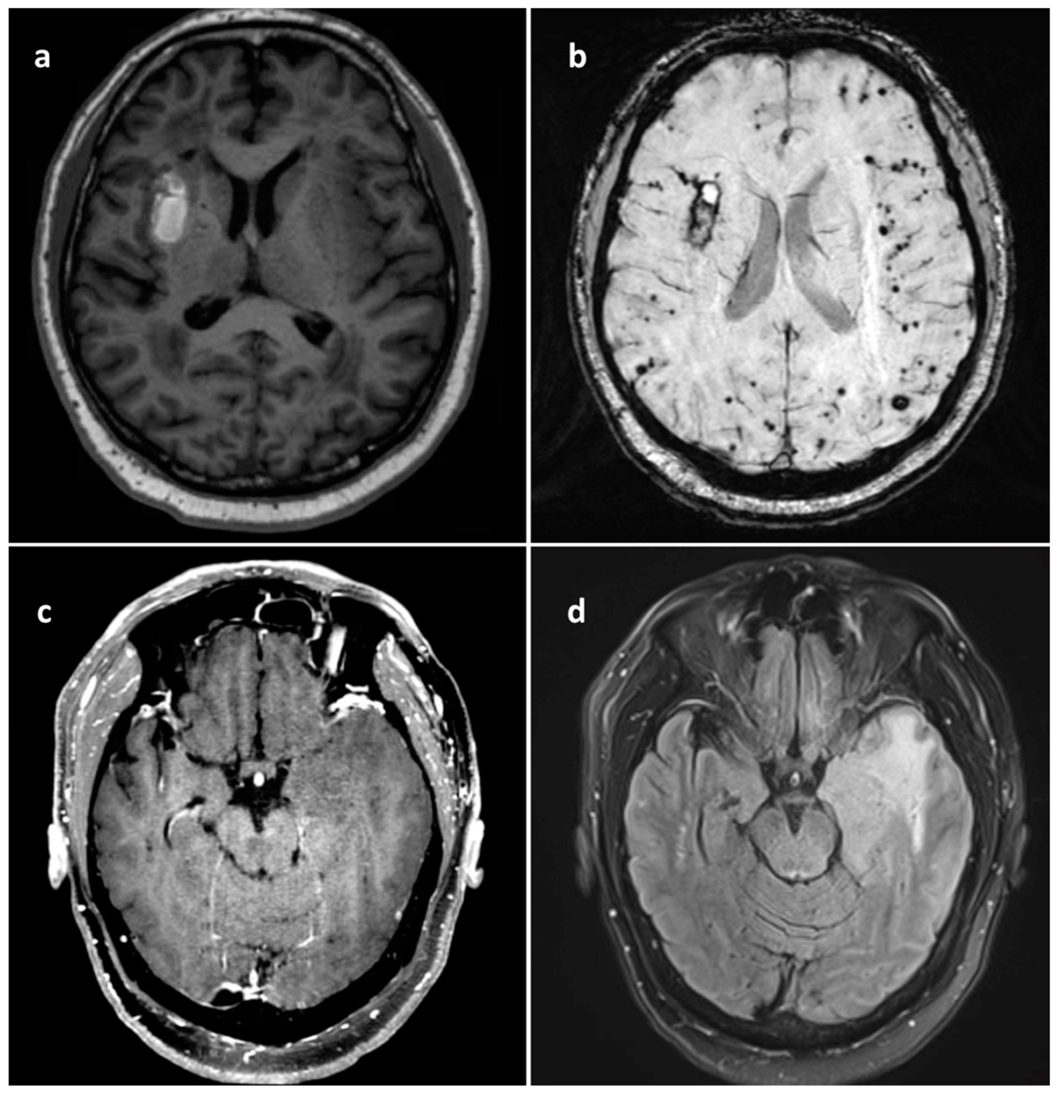 Brainsci 14 00143 g001