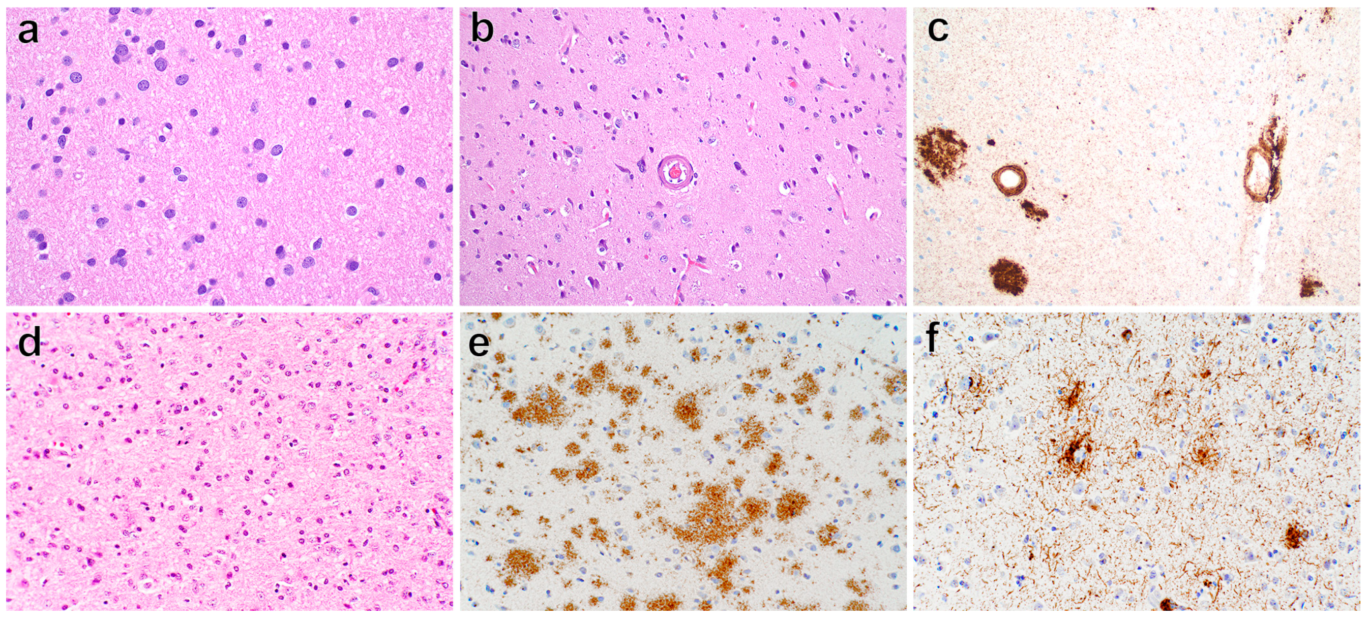 Brainsci 14 00143 g002