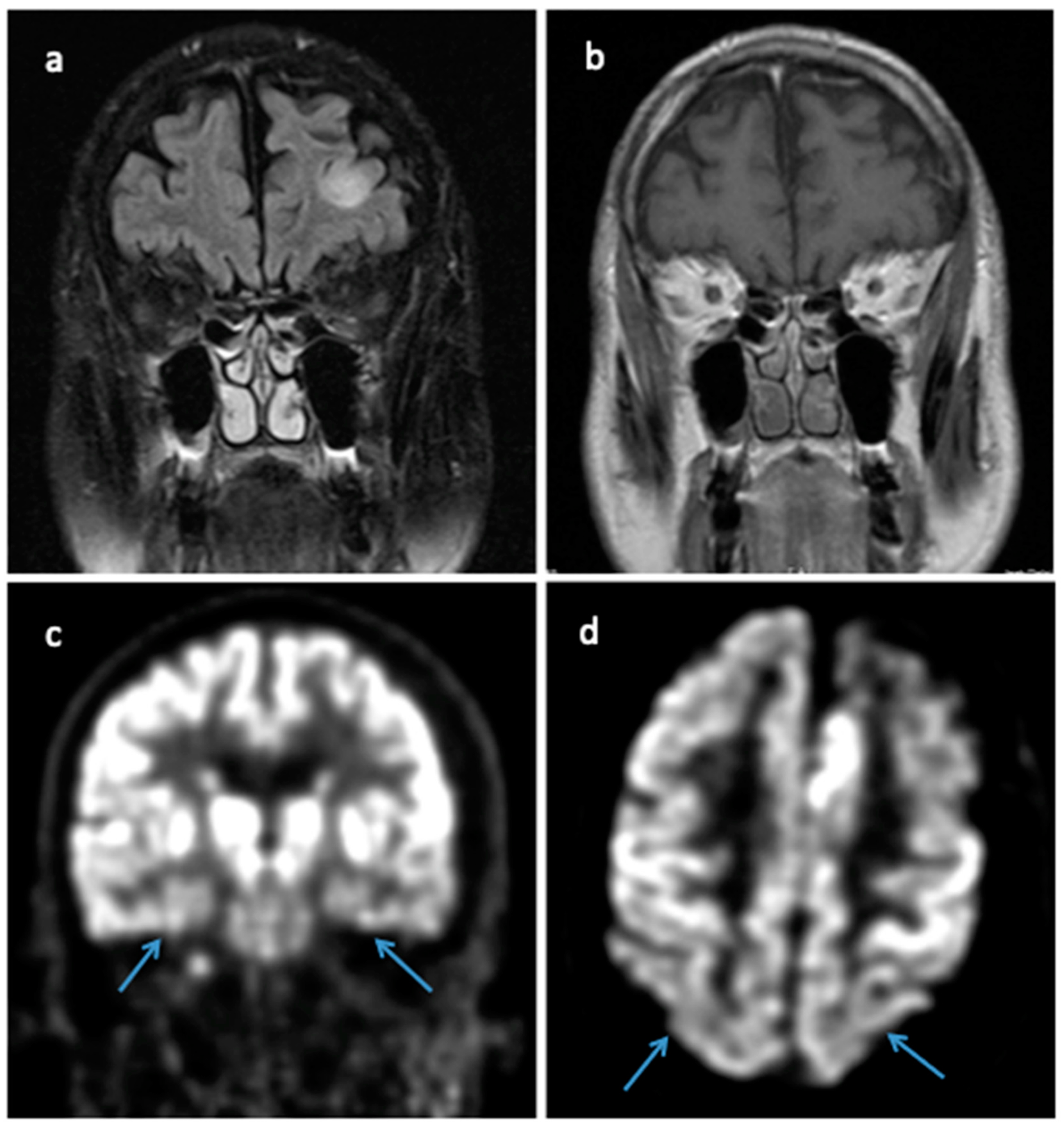 Brainsci 14 00143 g003
