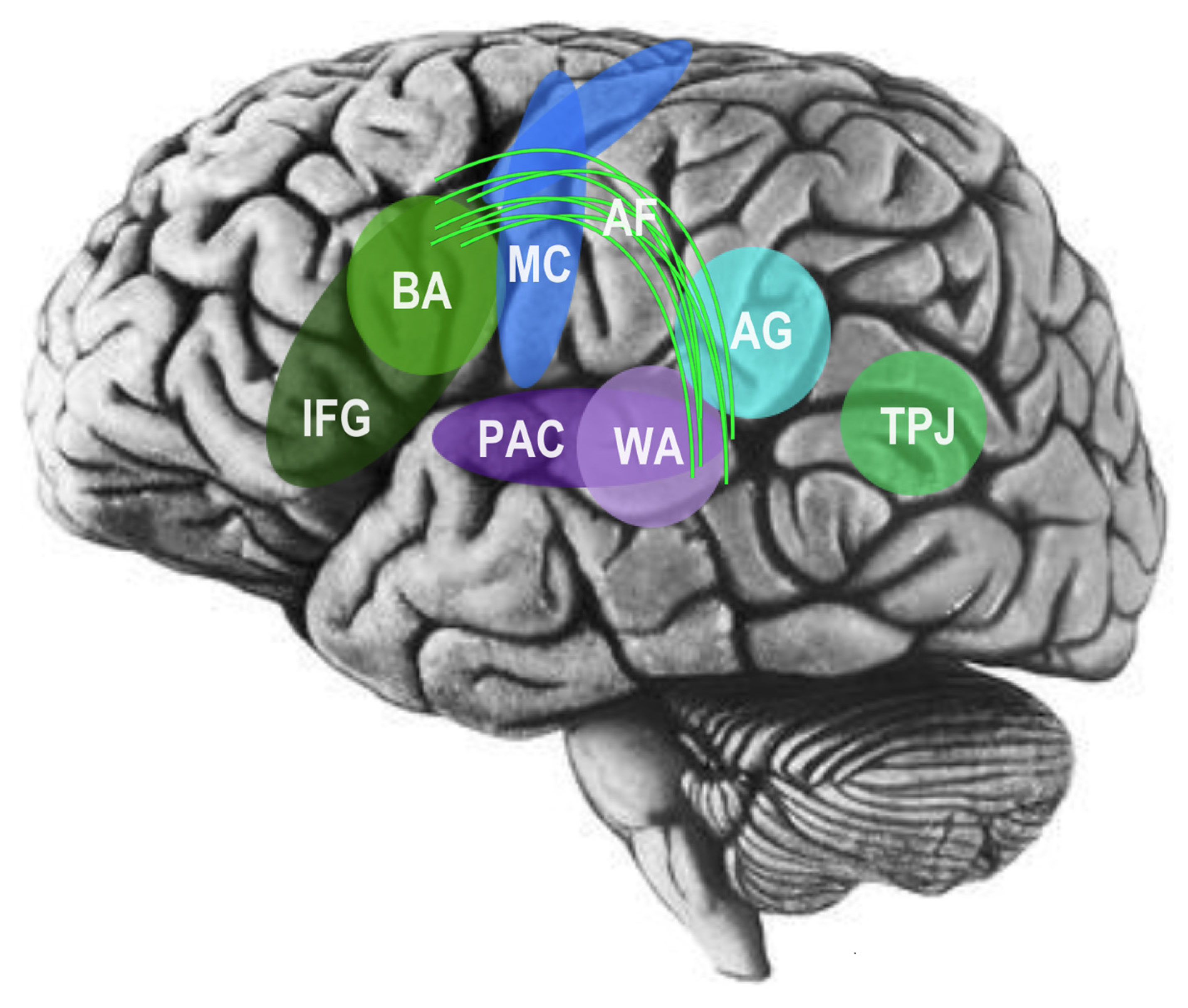 Brainsci 14 00166 g004 Brainsci 14 00166 g004