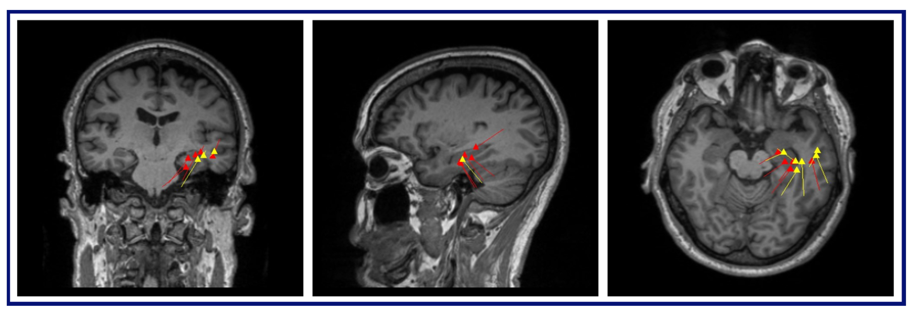 Brainsci 14 00173 g0a1