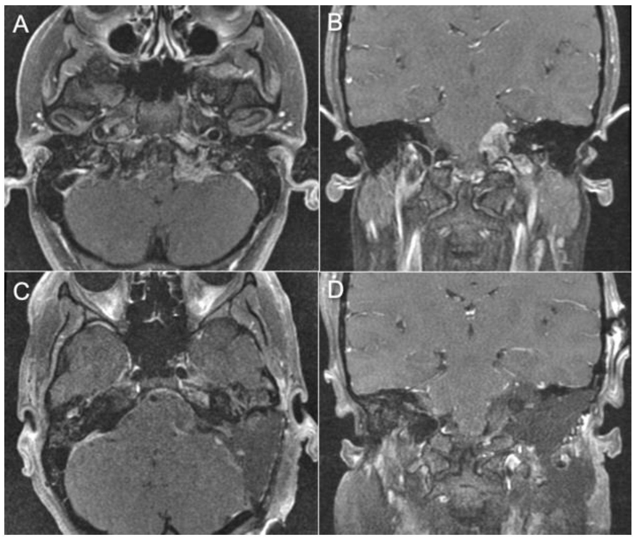 Brainsci 14 00182 g005