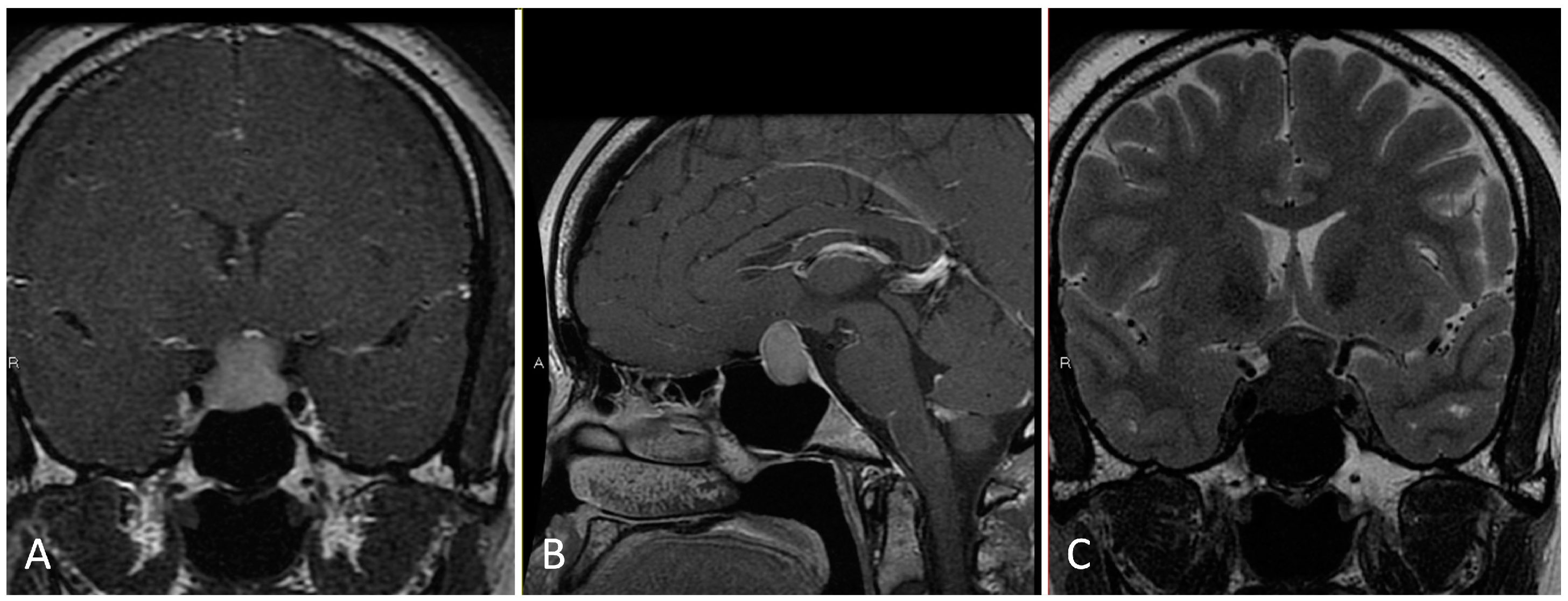 Brainsci 14 00207 g001
