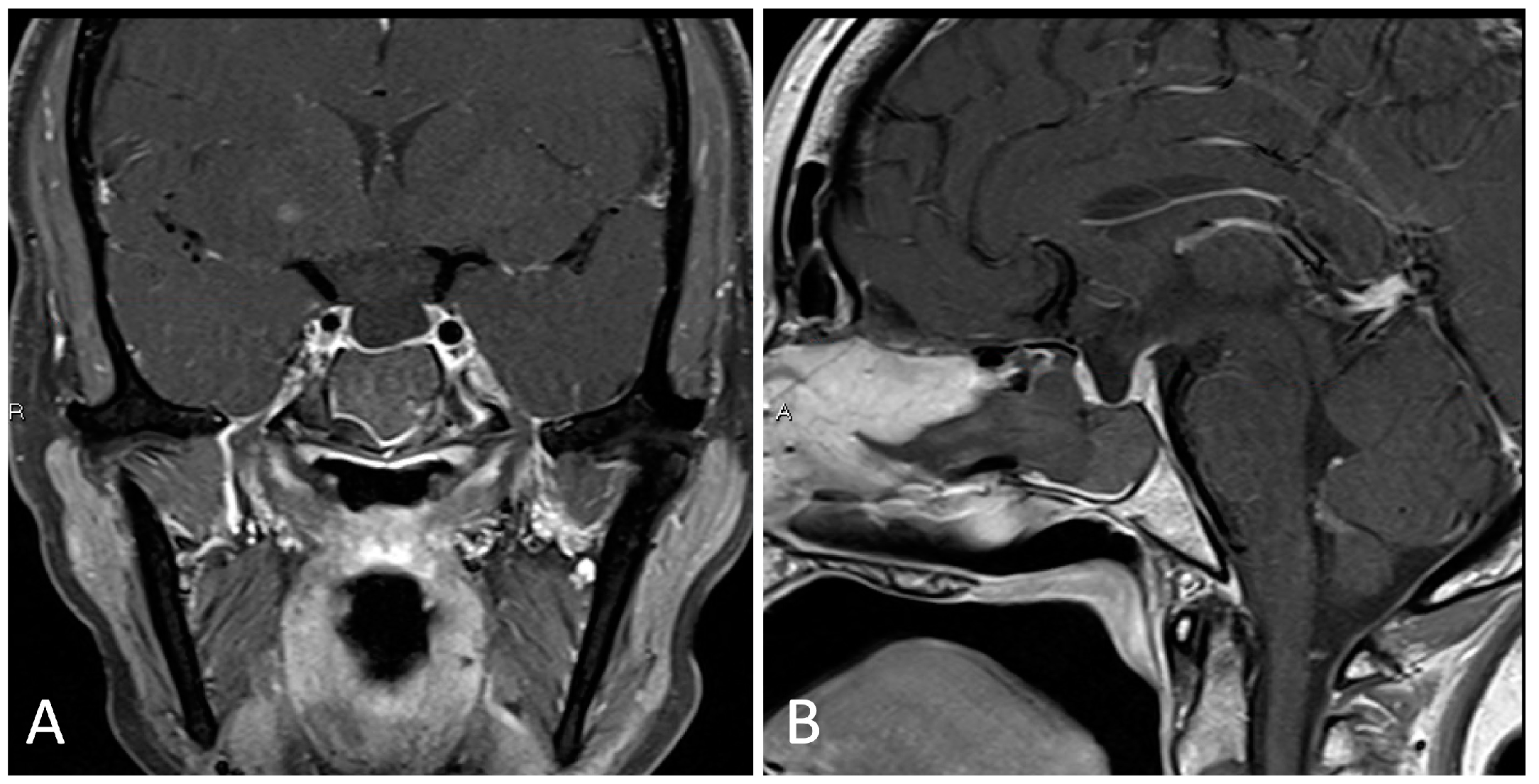 Brainsci 14 00207 g002