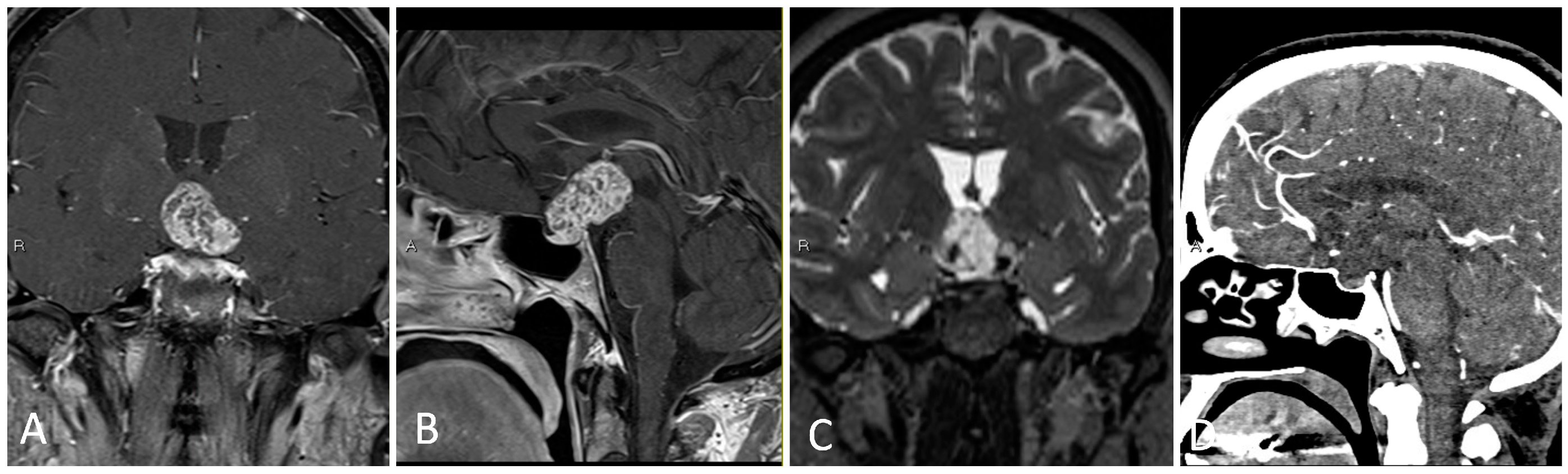 Brainsci 14 00207 g003