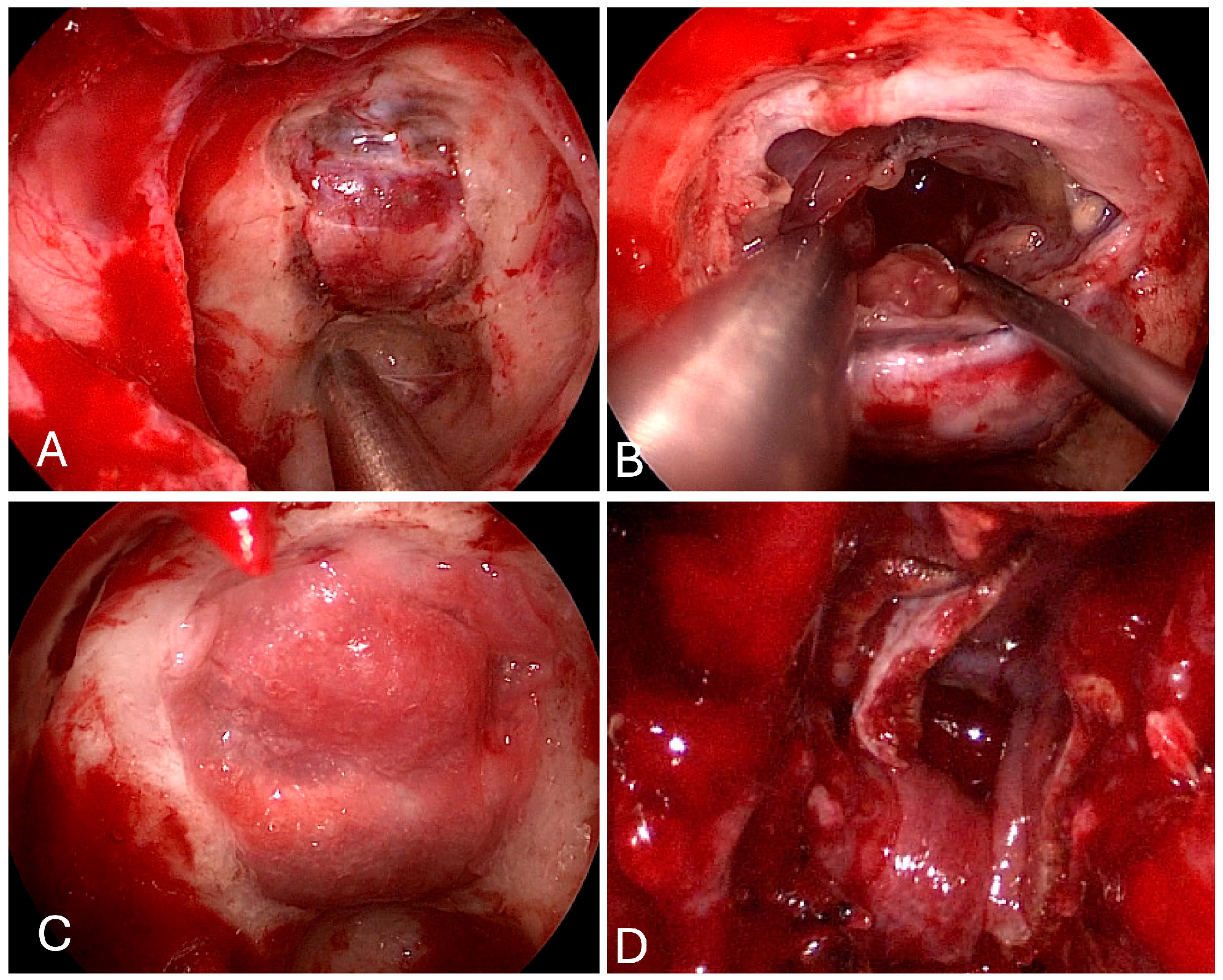 Brainsci 14 00207 g004