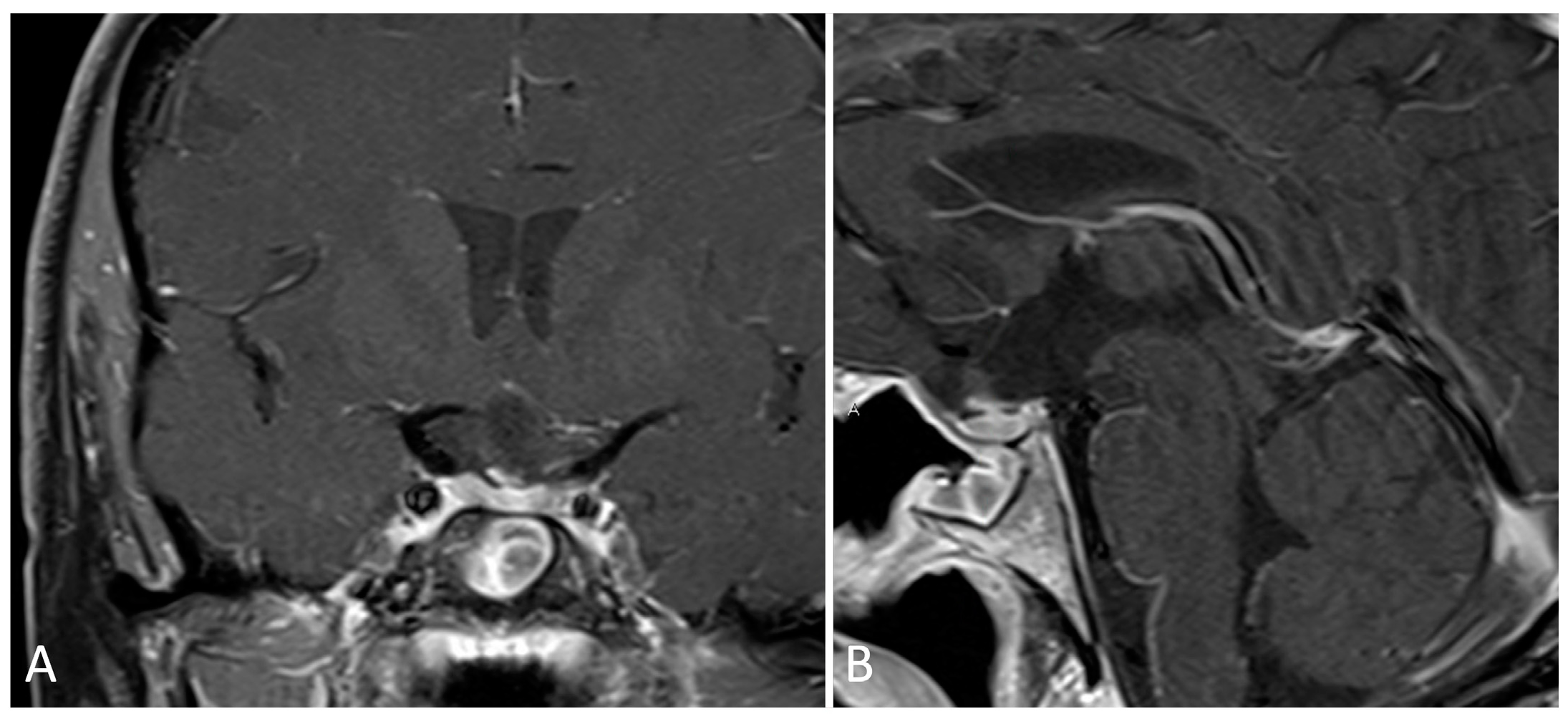 Brainsci 14 00207 g005