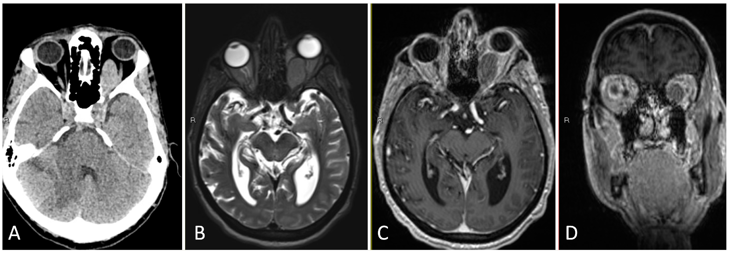 Brainsci 14 00207 g006