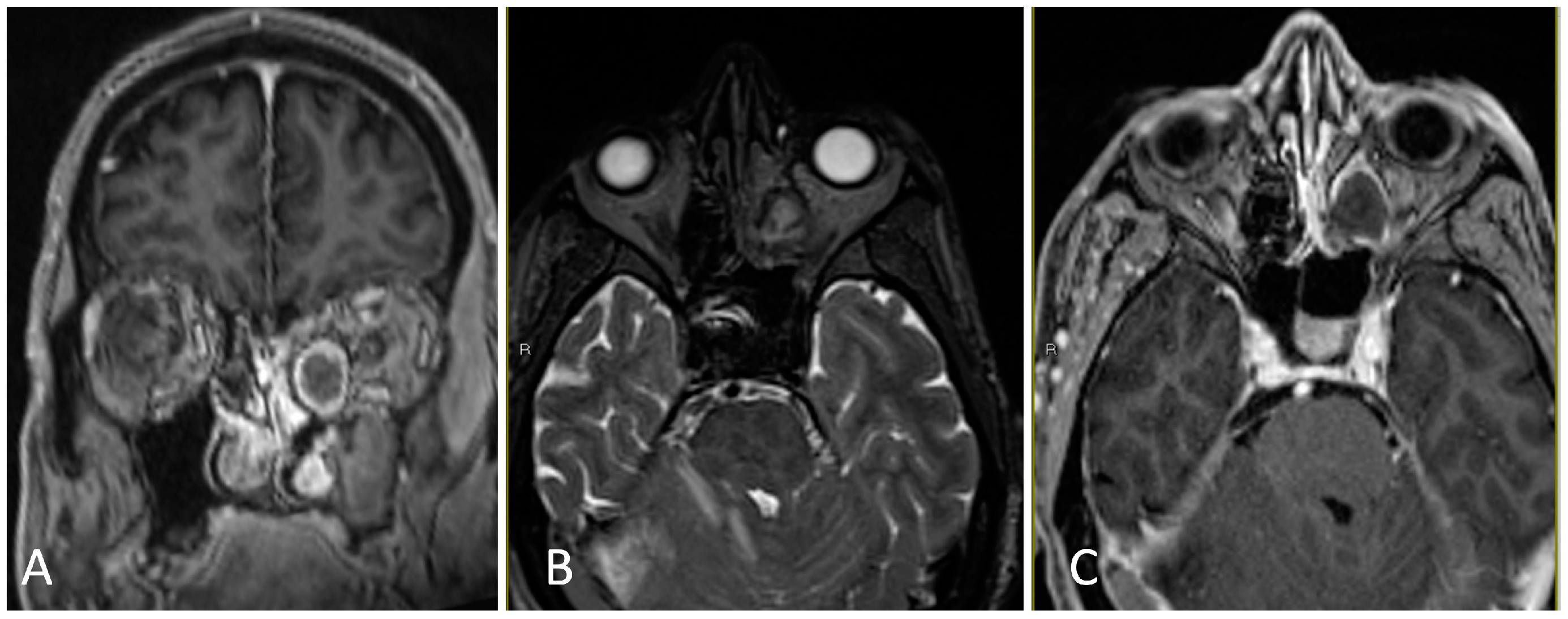 Brainsci 14 00207 g008