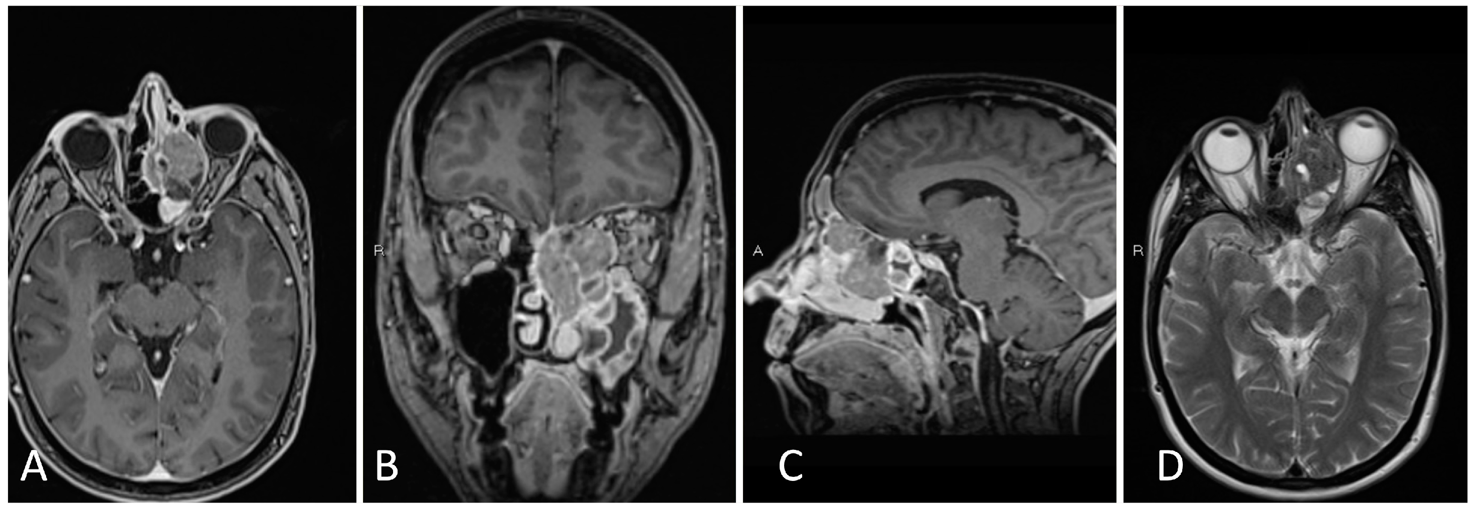 Brainsci 14 00207 g009