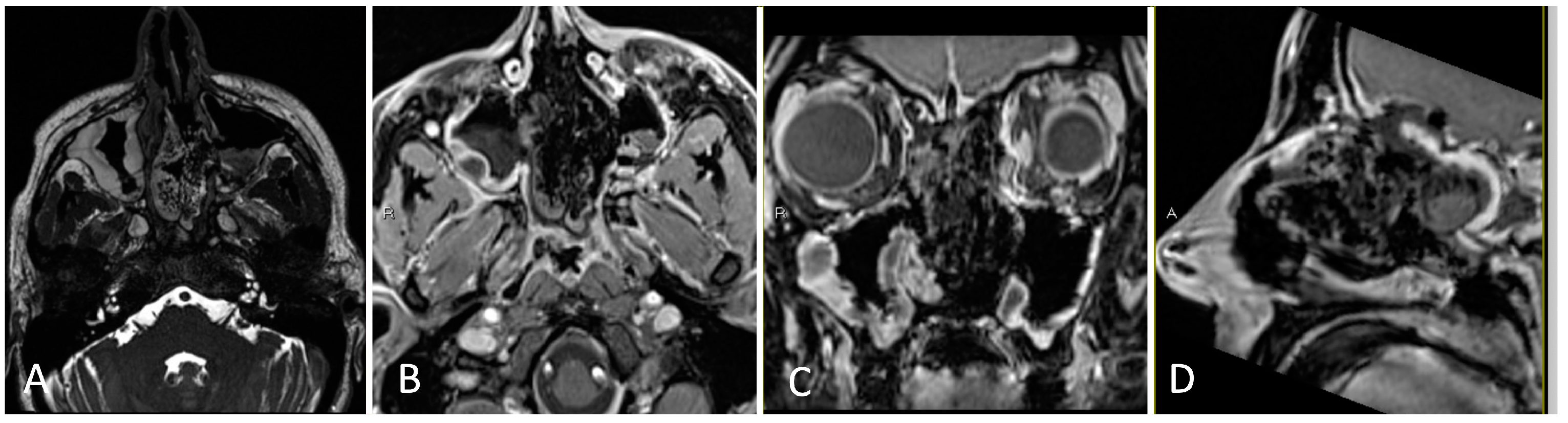 Brainsci 14 00207 g011