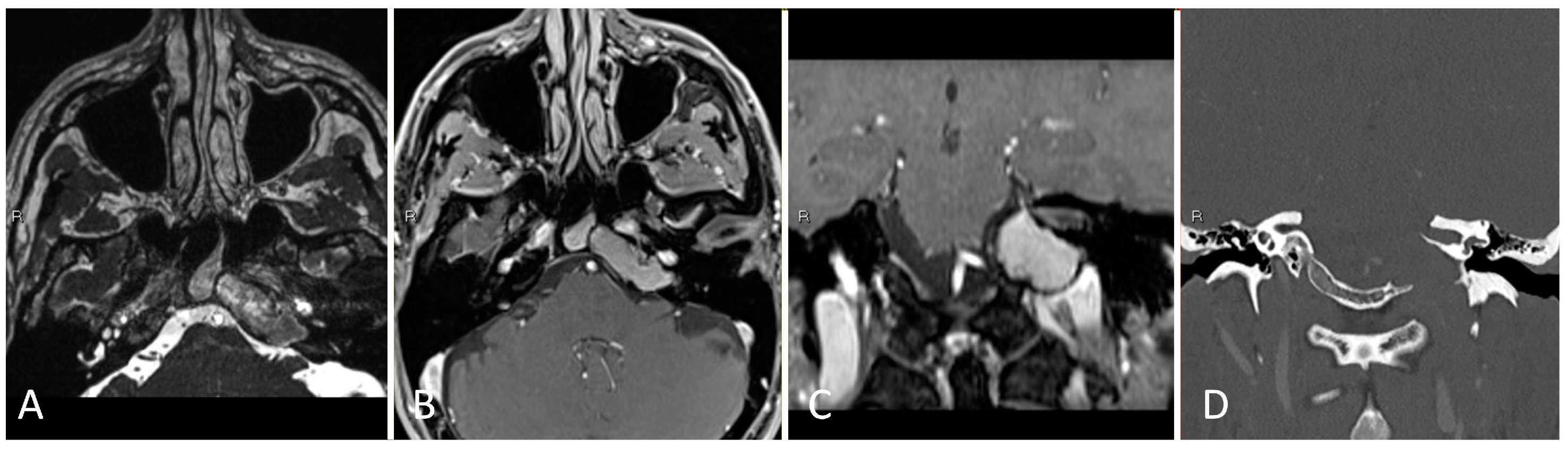 Brainsci 14 00207 g012