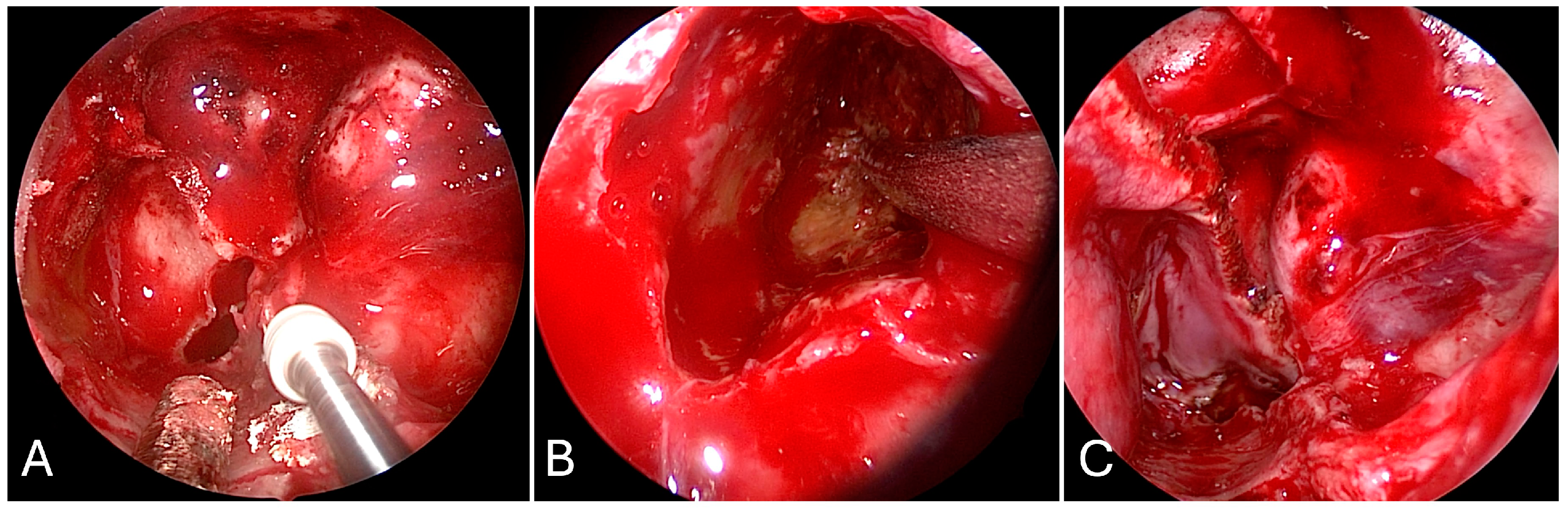 Brainsci 14 00207 g013