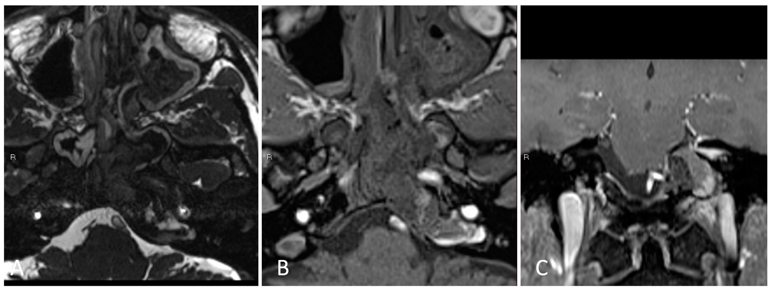 Brainsci 14 00207 g014