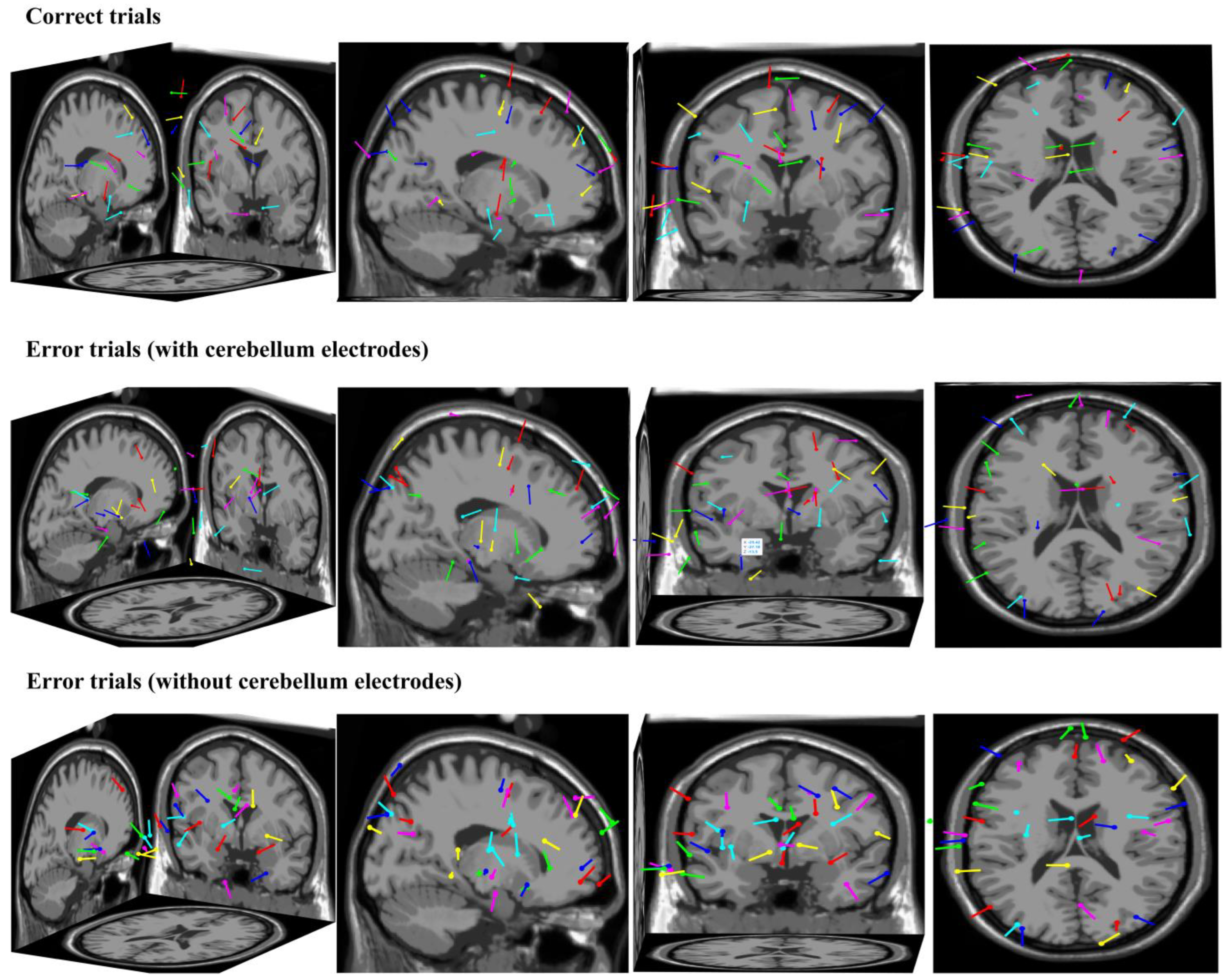 Brainsci 14 00214 g008