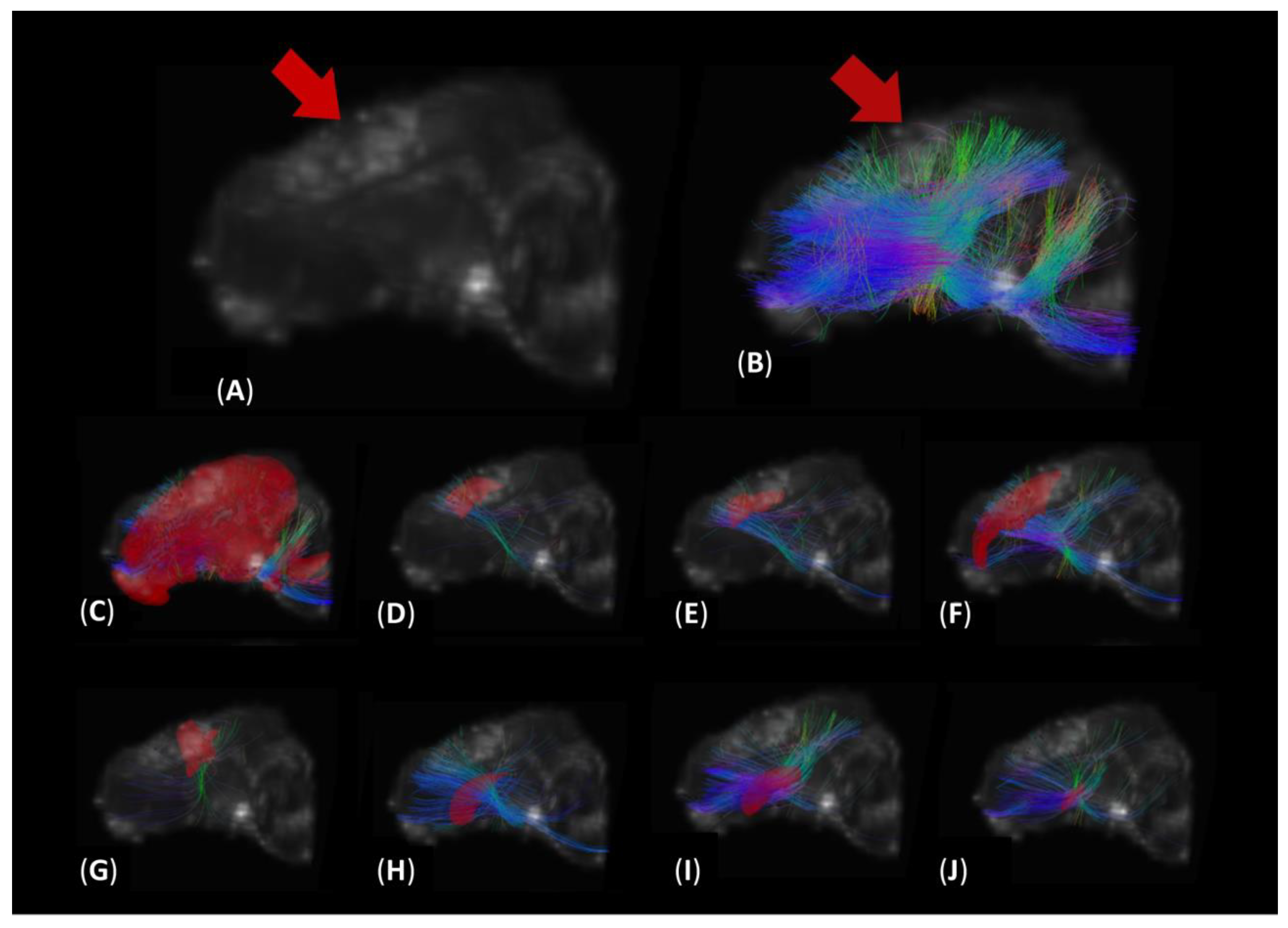 Brainsci 14 00247 g002