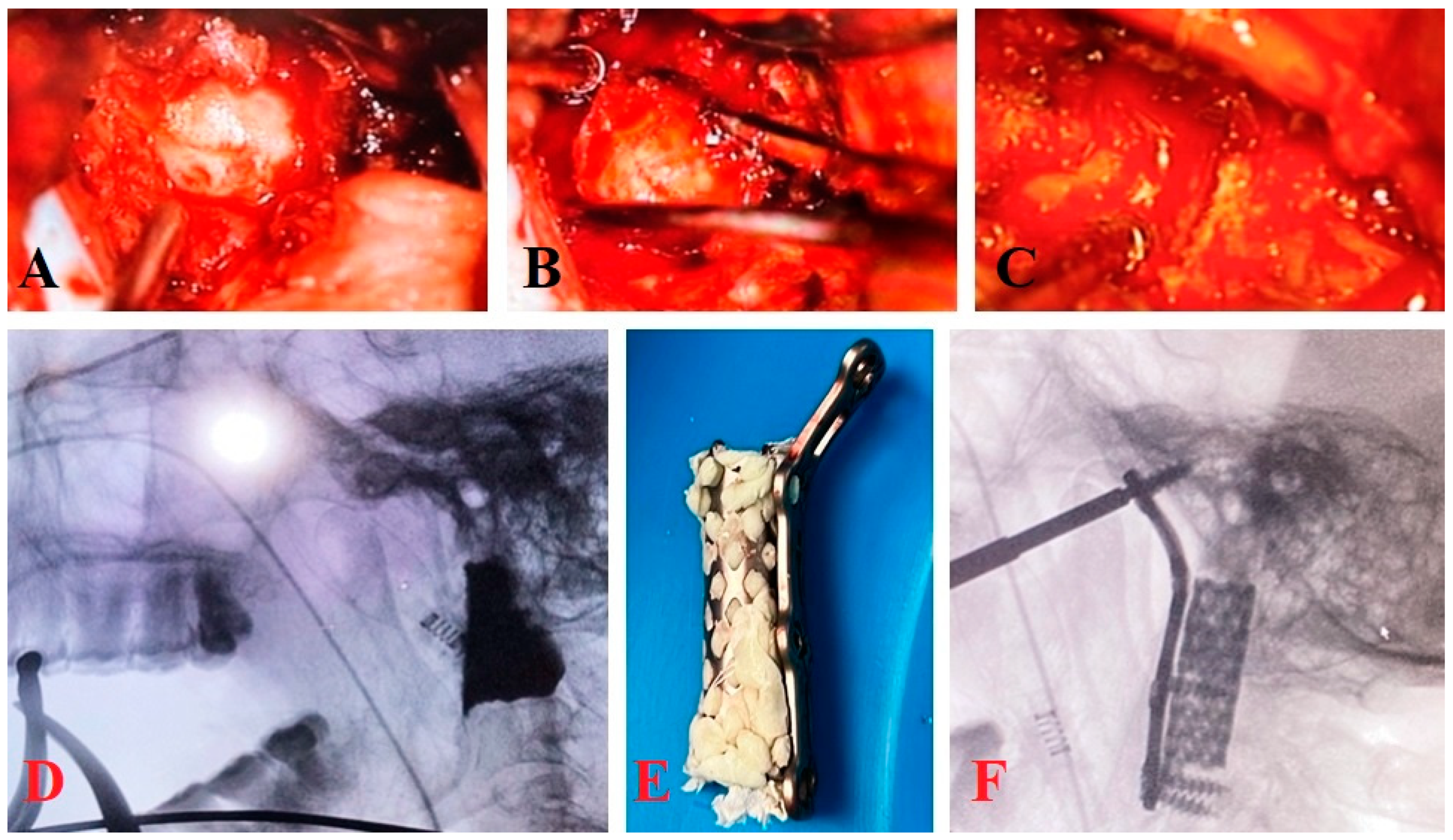 Brainsci 14 00254 g001