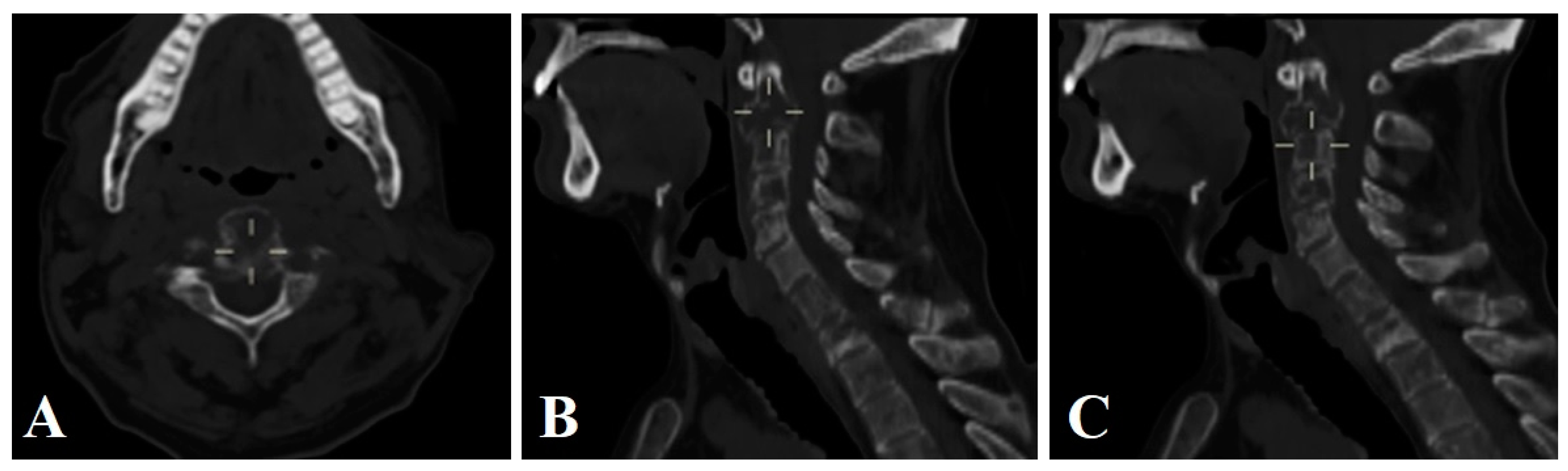 Brainsci 14 00254 g003