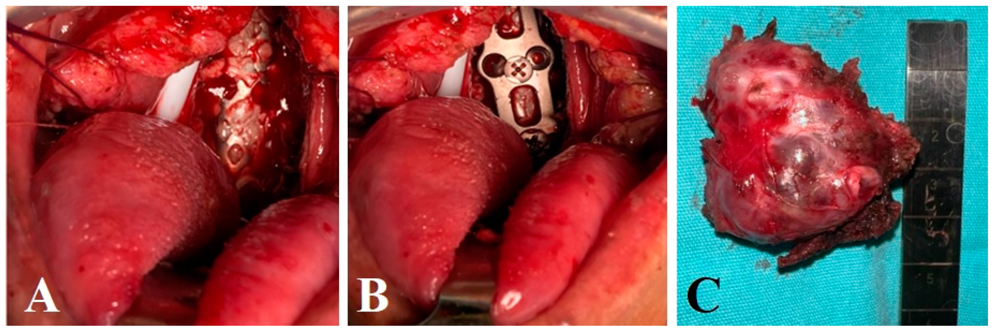 Brainsci 14 00254 g004