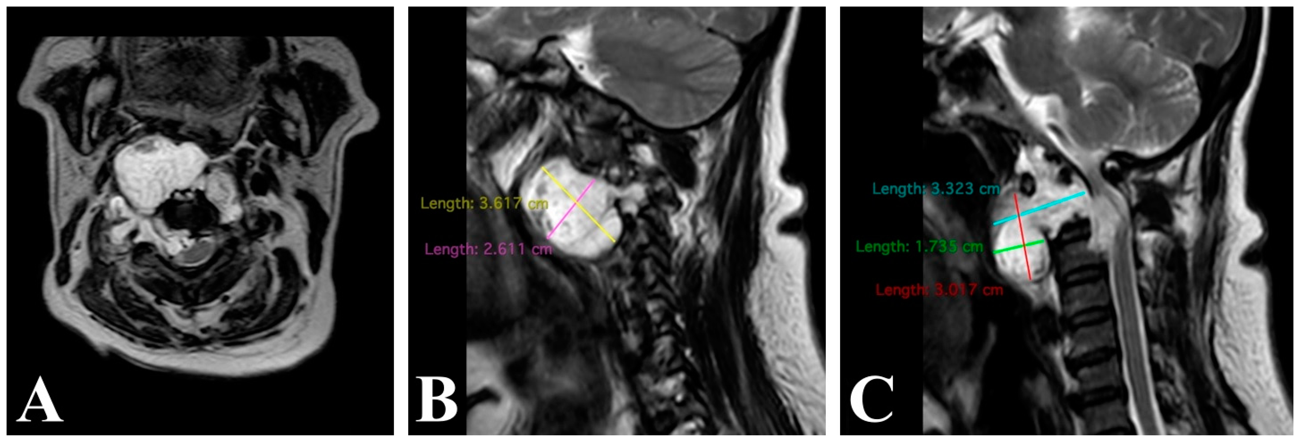Brainsci 14 00254 g005