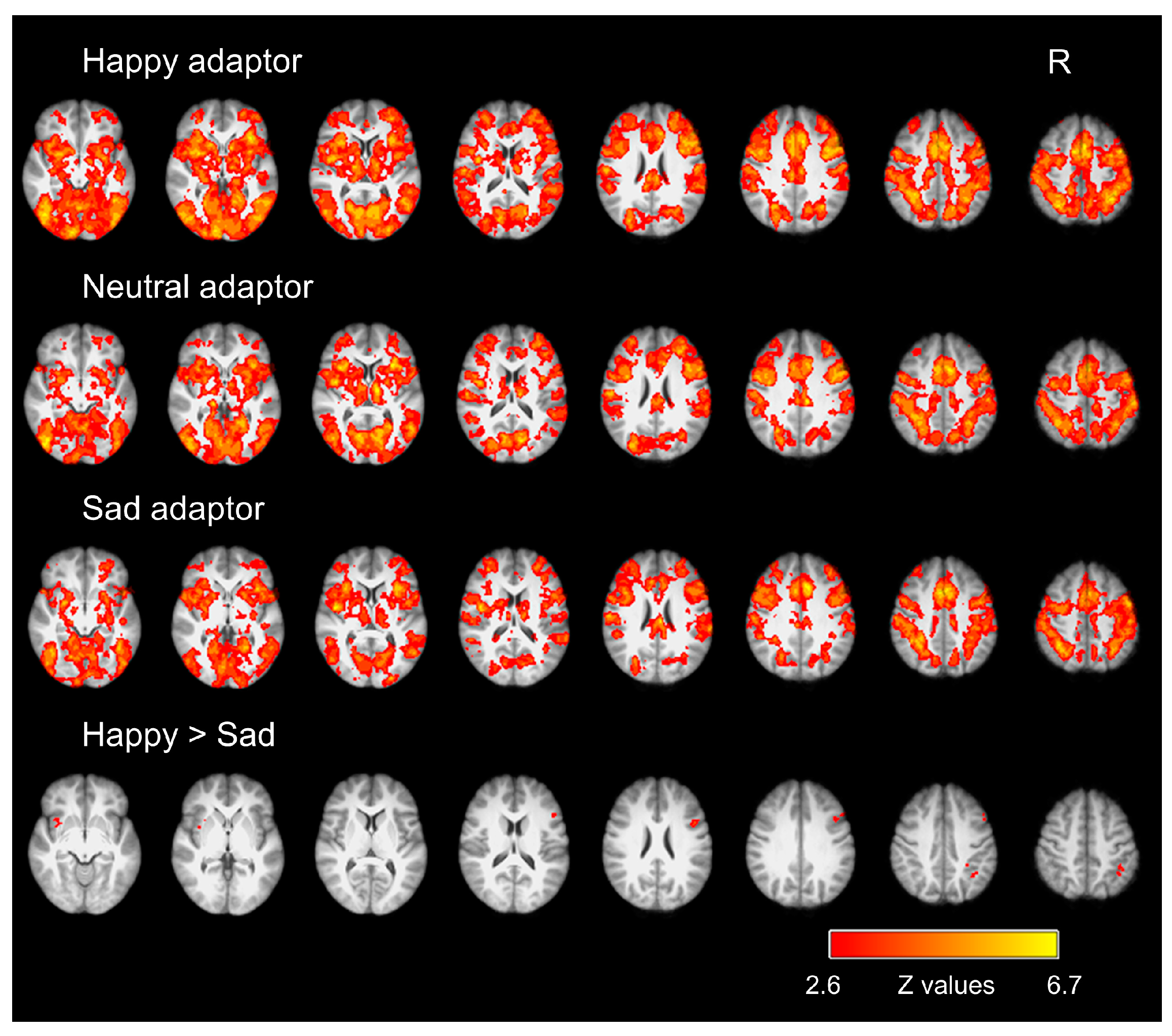 Brainsci 14 00257 g003 Brainsci 14 00257 g003