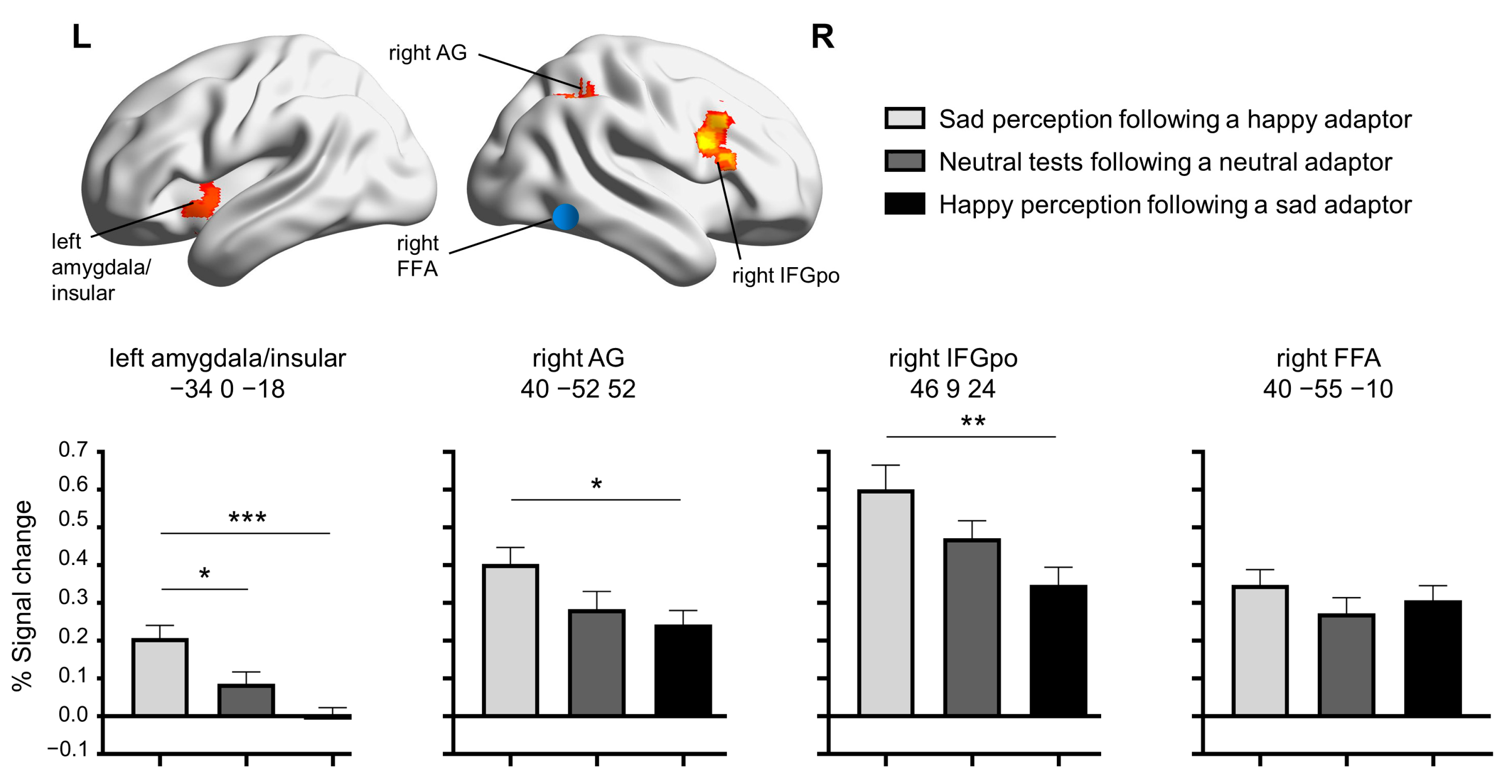 Brainsci 14 00257 g004 Brainsci 14 00257 g004