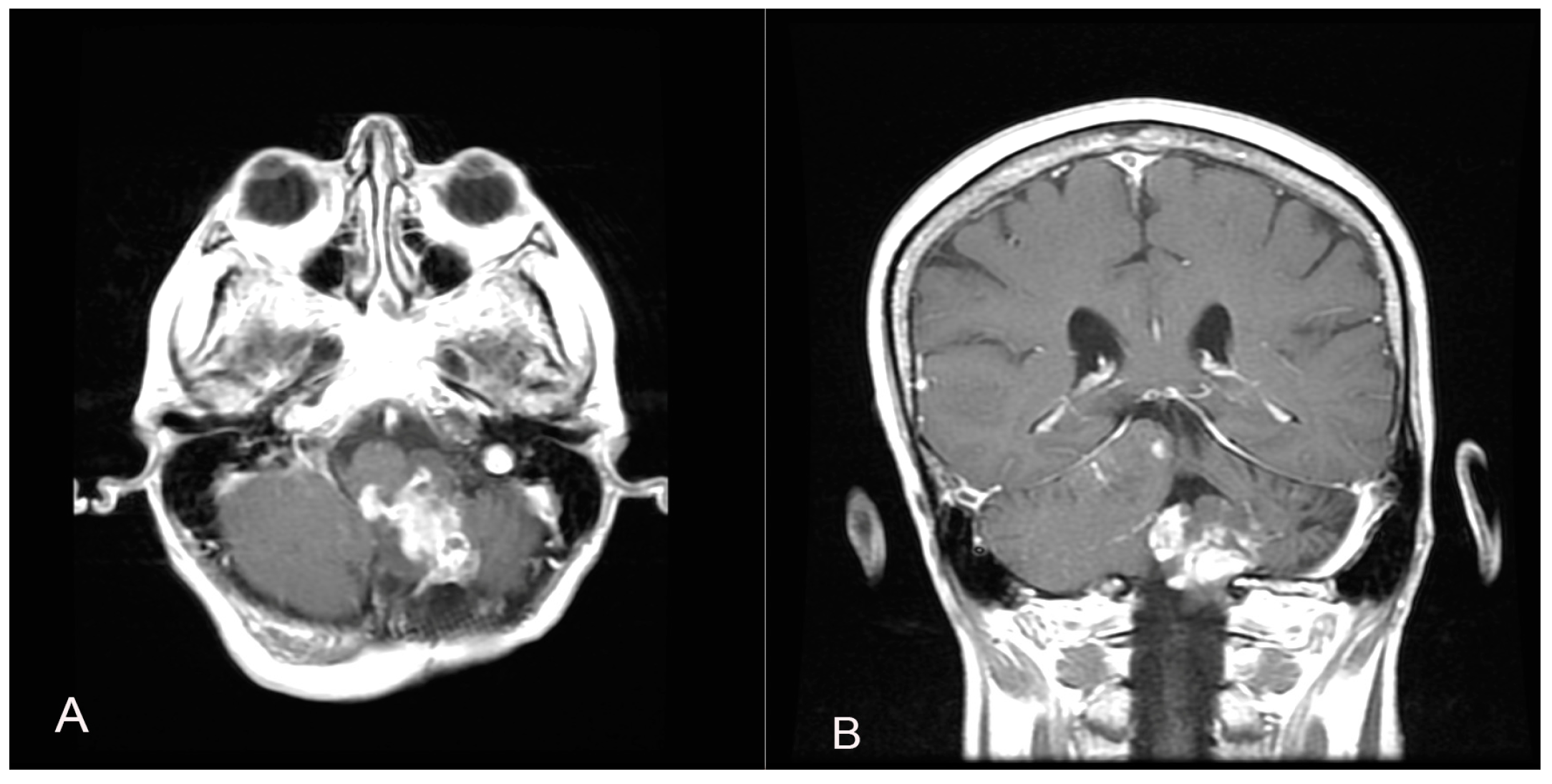 Brainsci 14 00286 g004