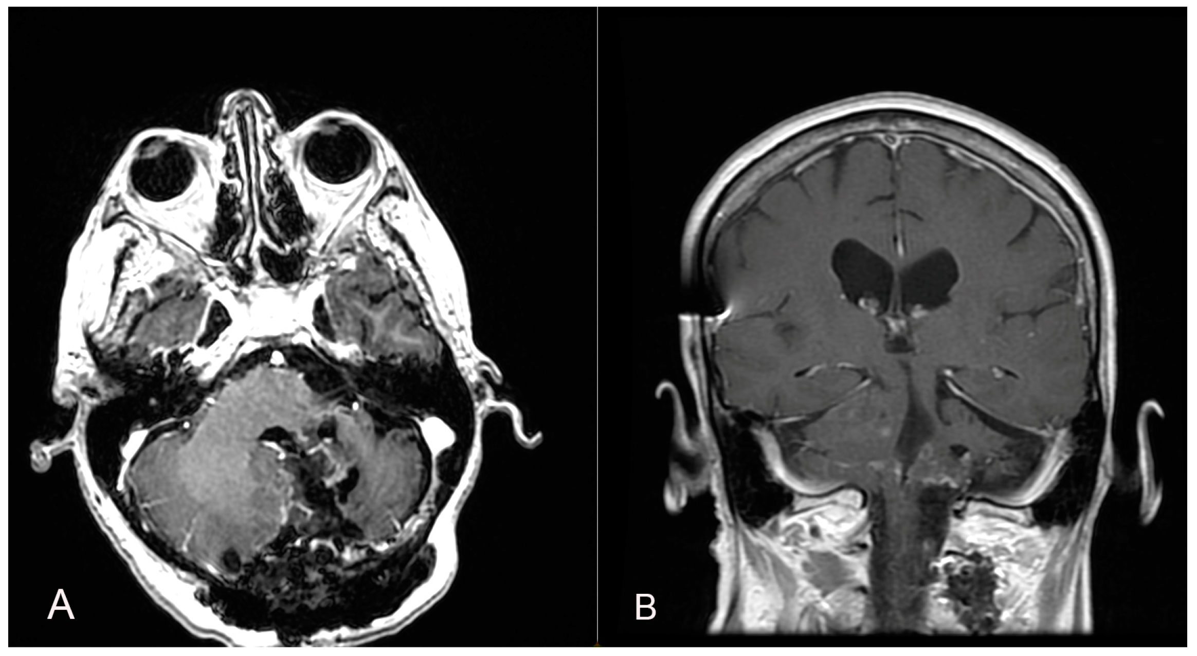 Brainsci 14 00286 g005