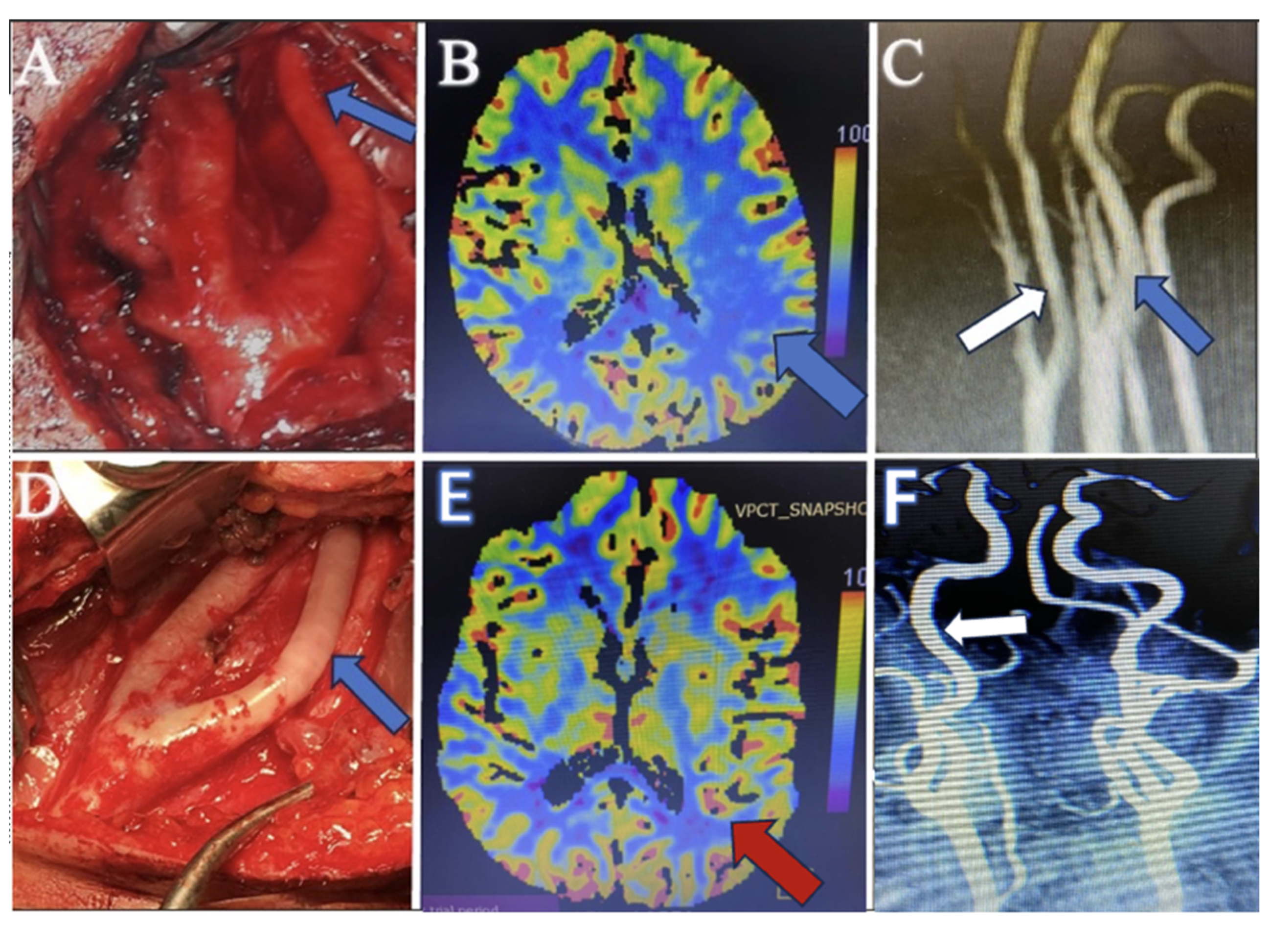Brainsci 14 00289 g003