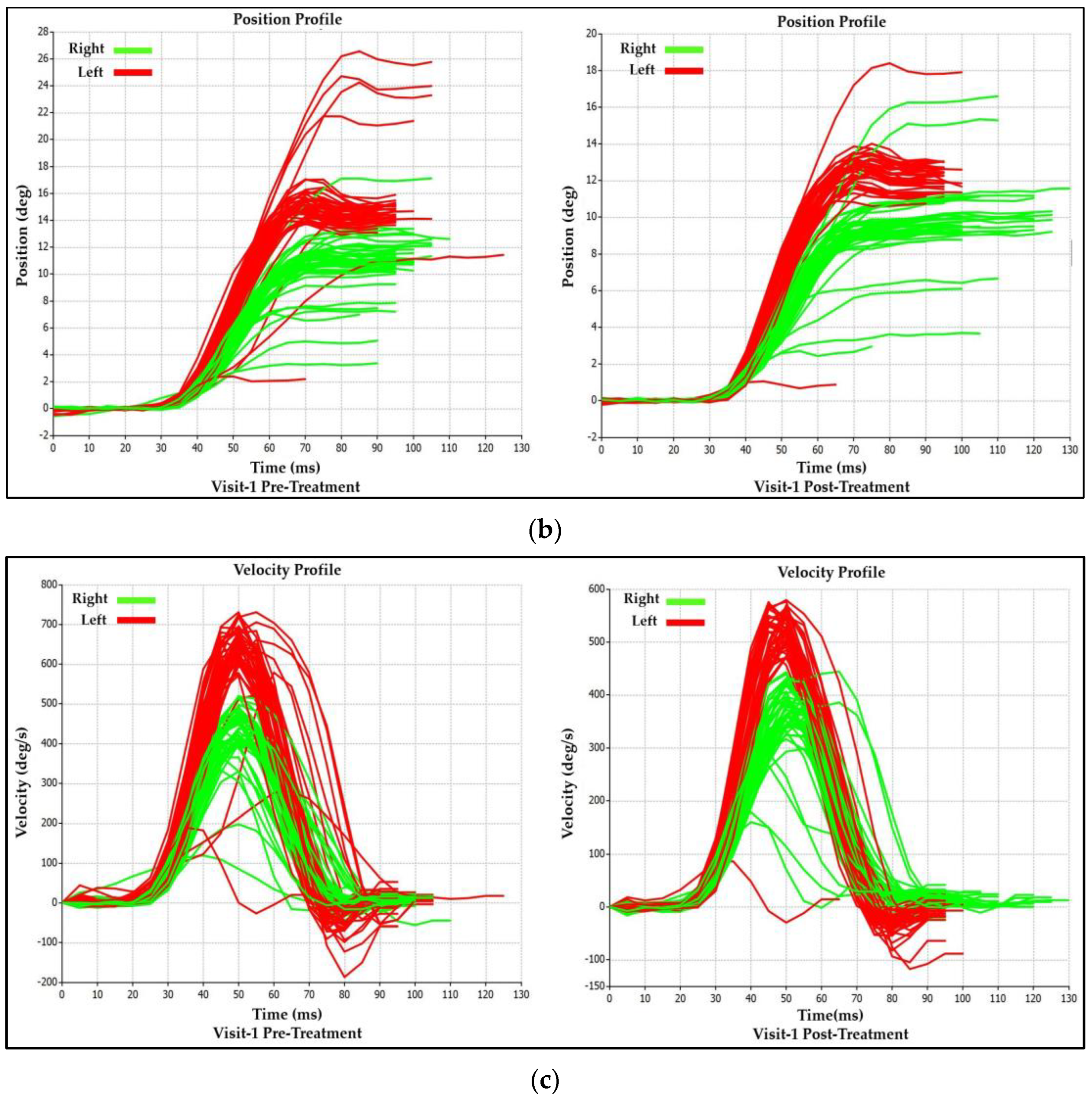 Brainsci 14 00292 g005b Brainsci 14 00292 g005b