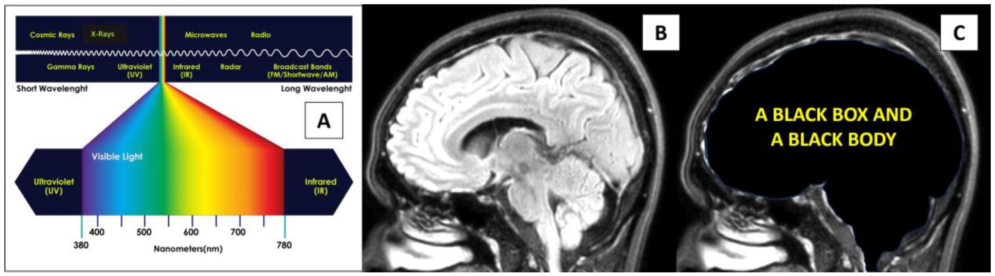 Light and the Brain: A Clinical Case Depicting the Effects