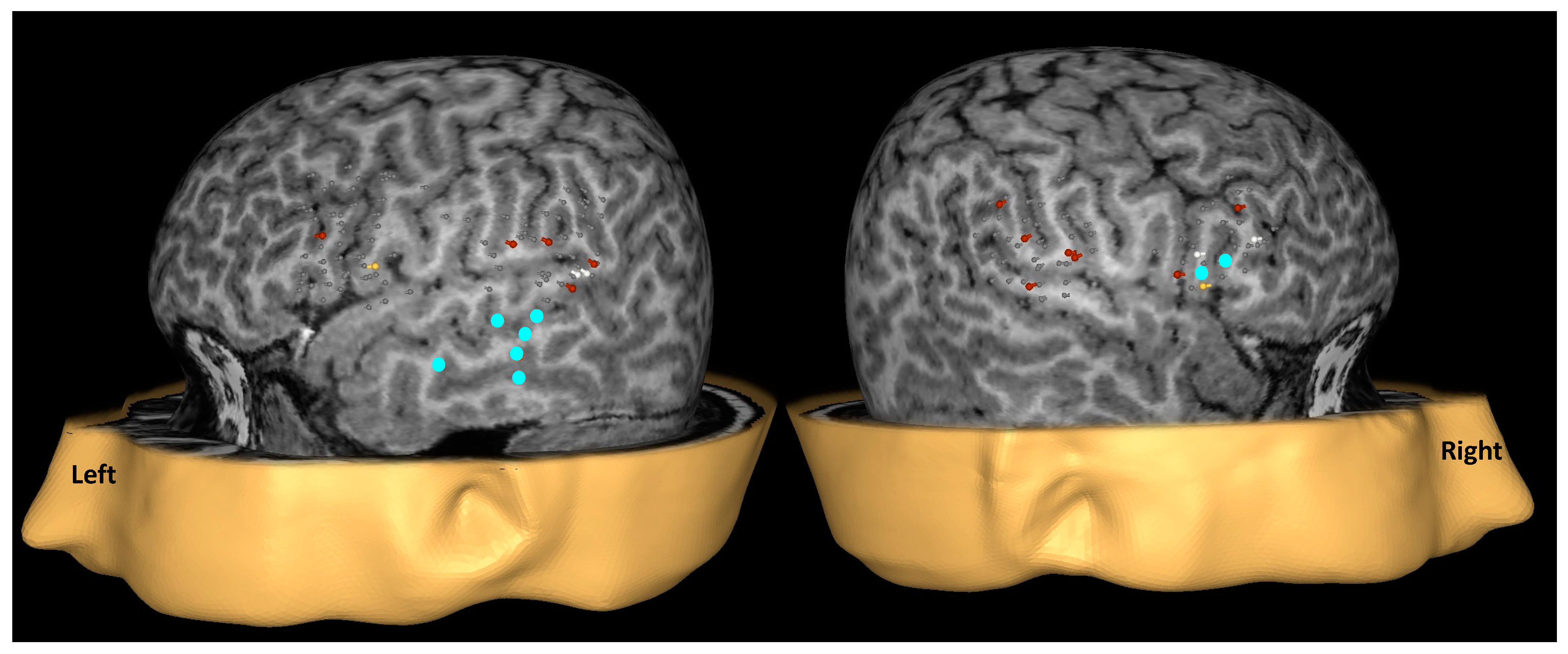 Brainsci 14 00336 g002