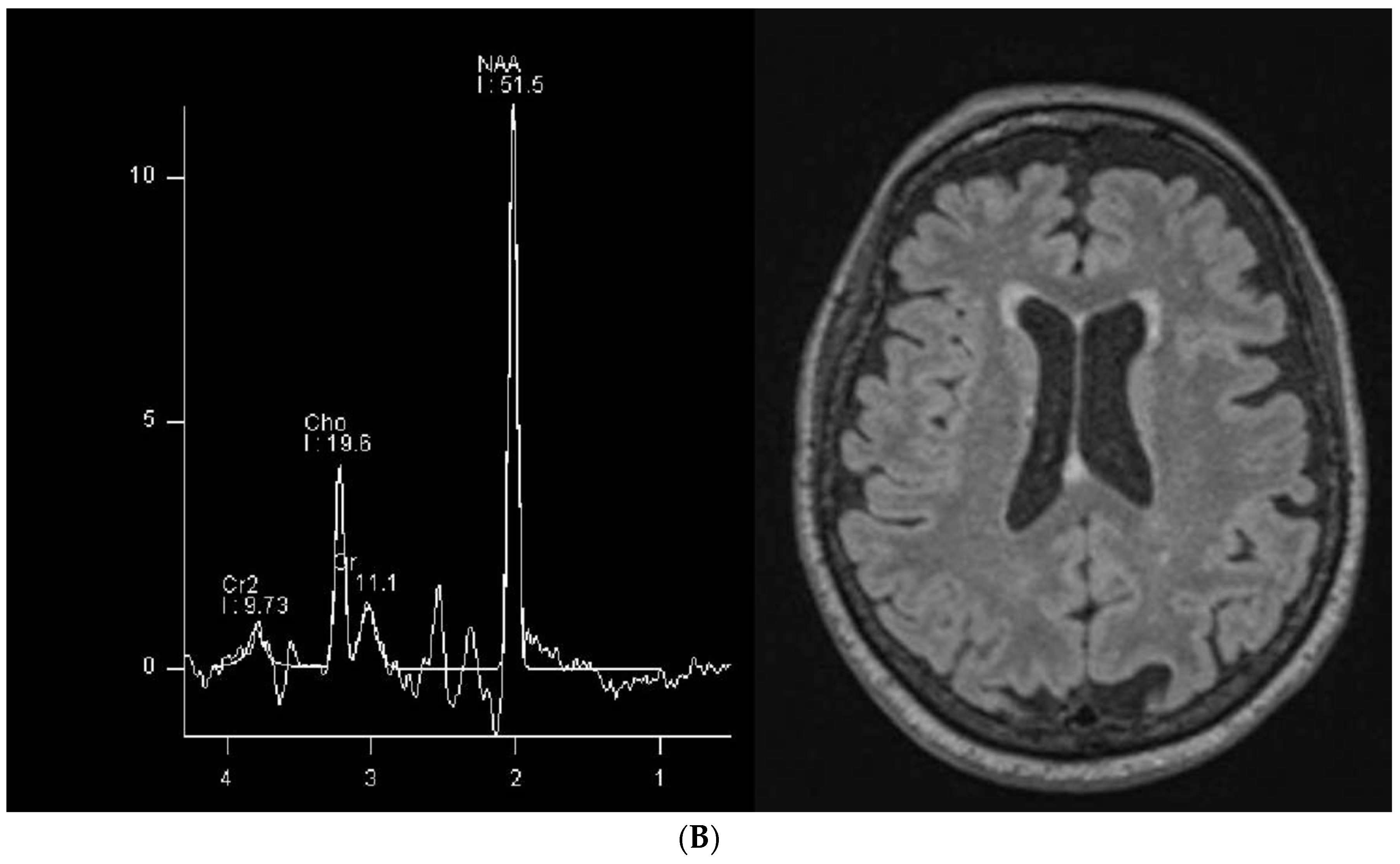 Brainsci 14 00337 g001b Brainsci 14 00337 g001b