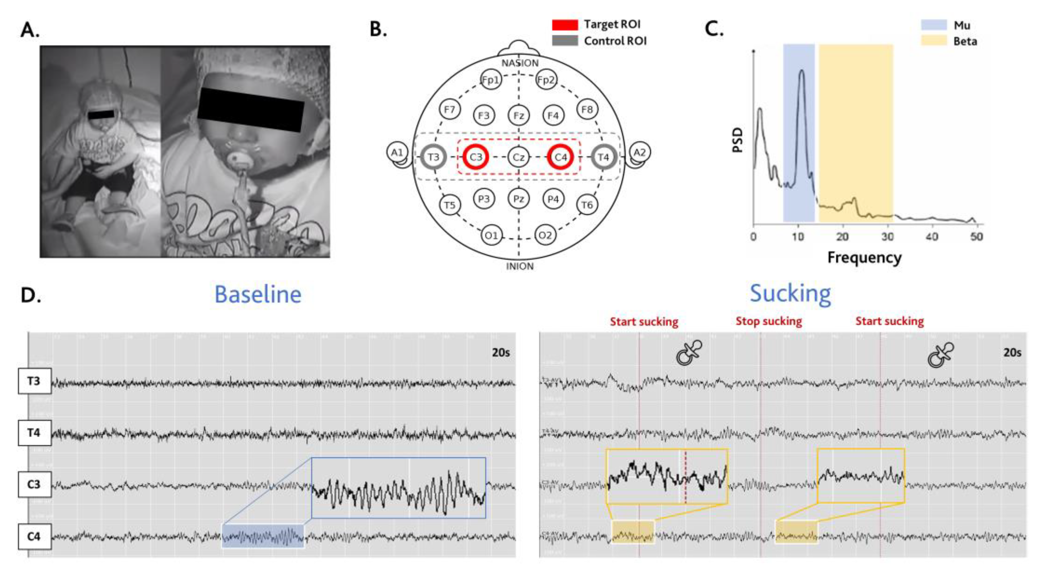 Brainsci 14 00402 g001