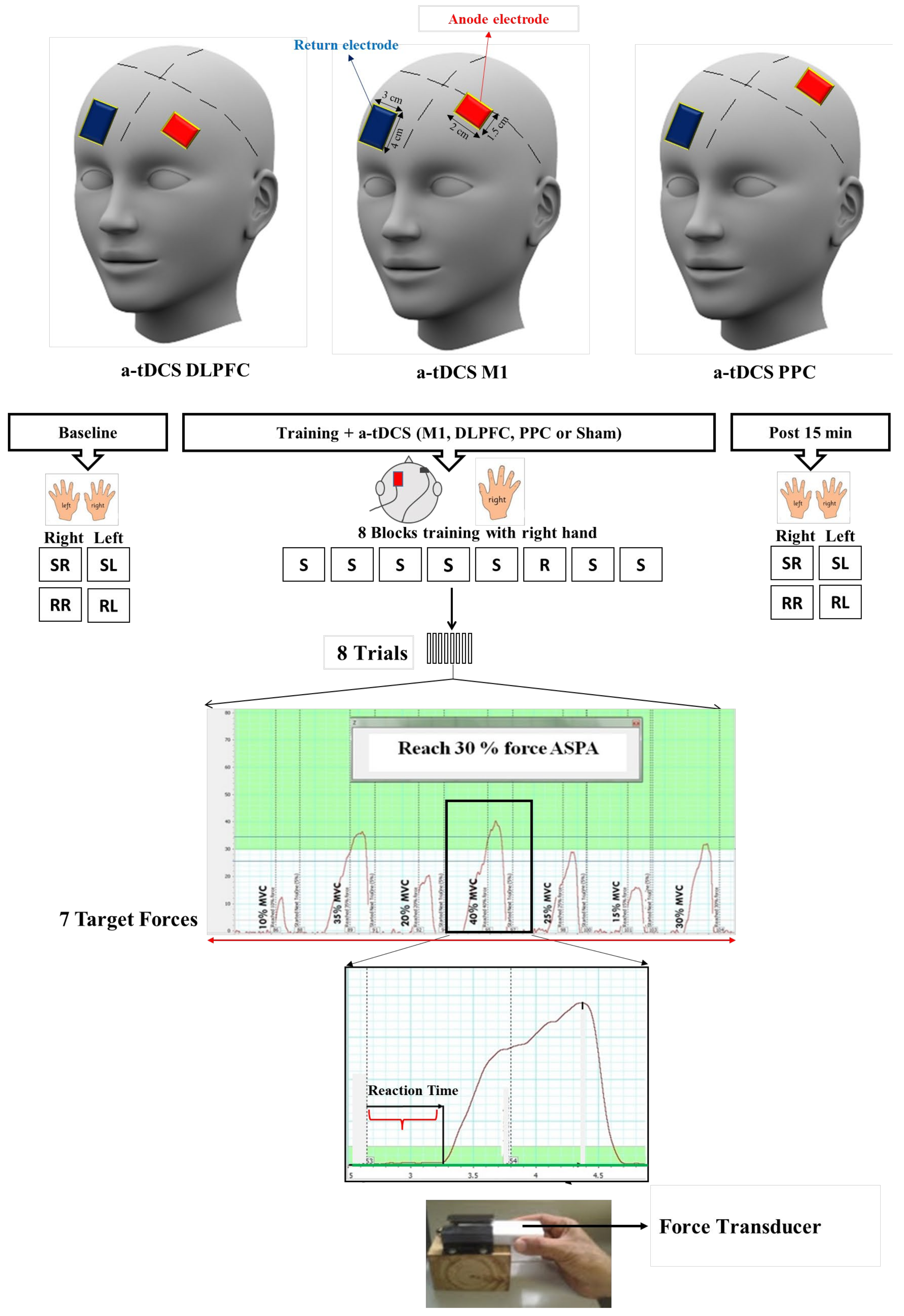 Brainsci 14 00408 g002 Brainsci 14 00408 g002