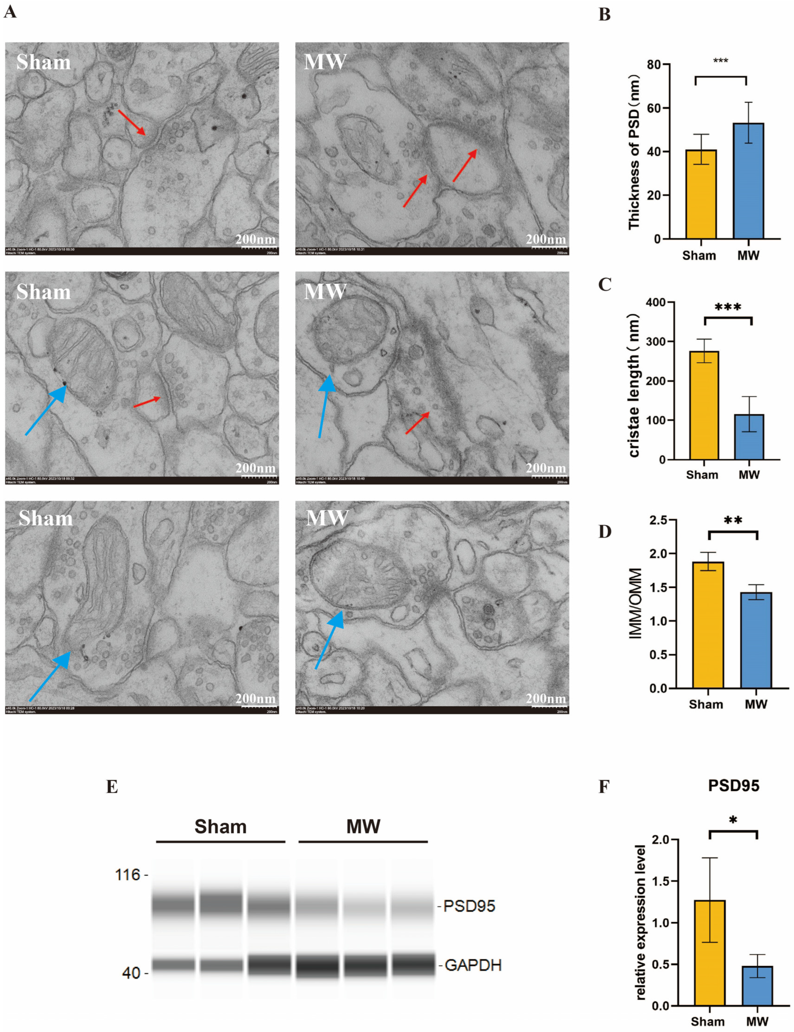 Brainsci 14 00441 g003 Brainsci 14 00441 g003